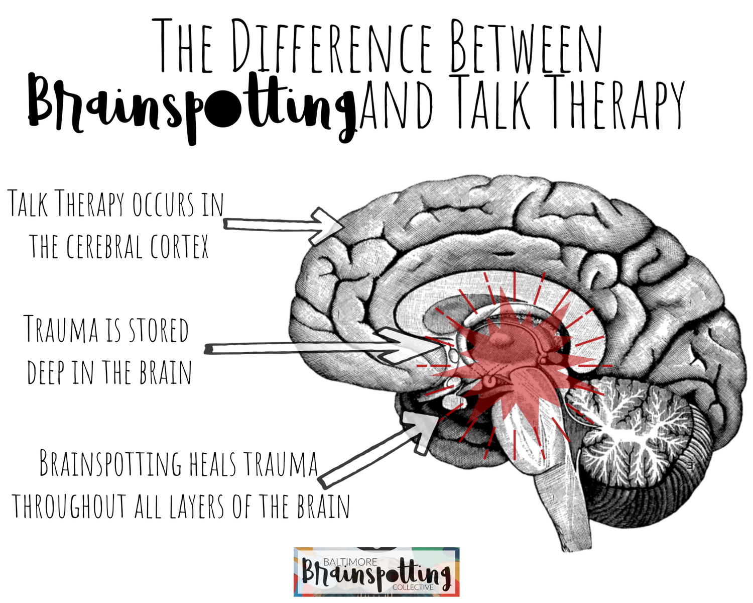 What is Brainspotting?