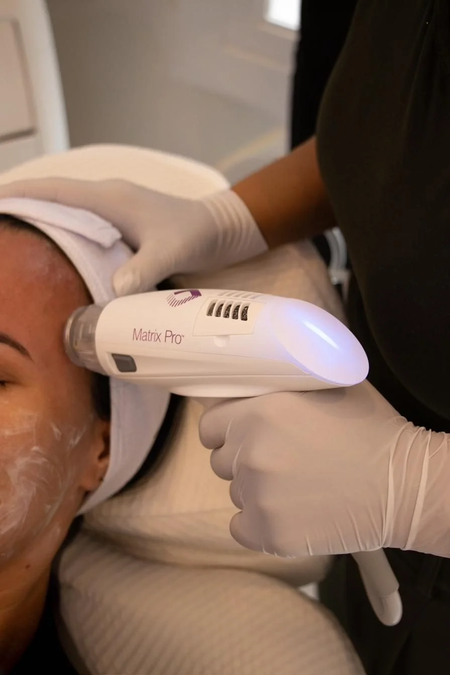 Signature facials and microneedling