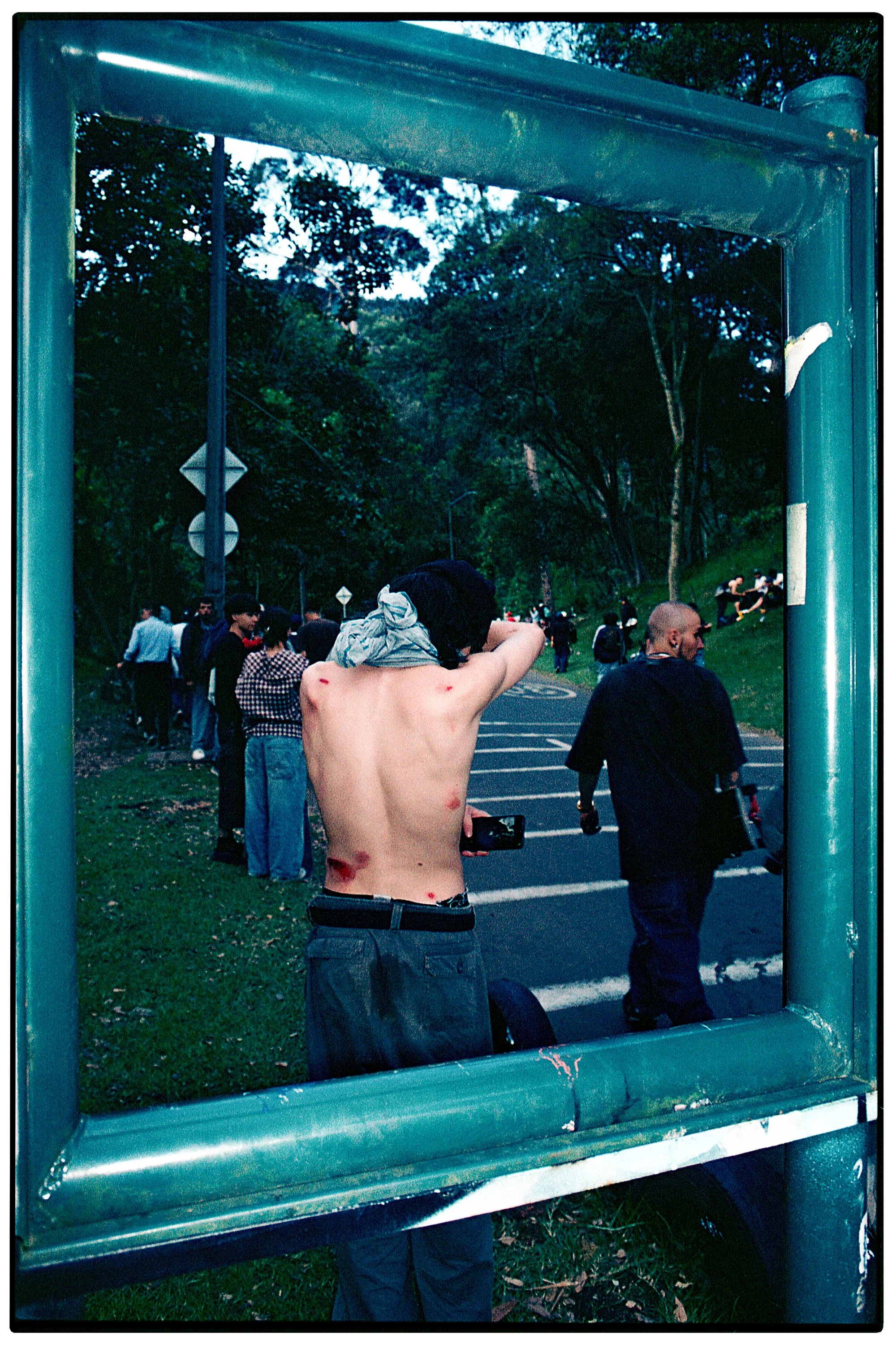 Un joven desnudo con heridas en la espalda y heridas de mordedura de insecto se refleja en un espejo en un parque con muchas personas en el fondo.
