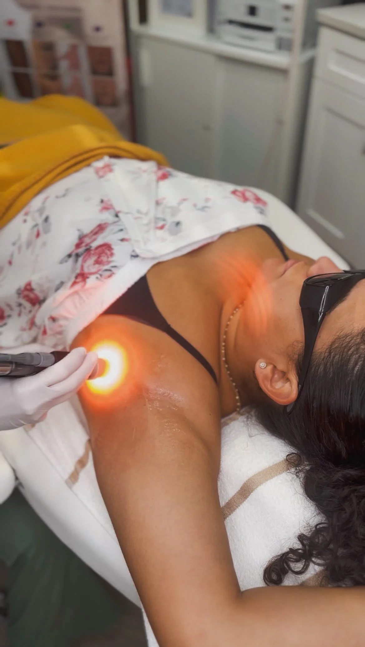 Underarm laser hair removal treatment using DEKA Motus AZ+ technology at Good Vibrations Aesthetics in Orlando, Florida.