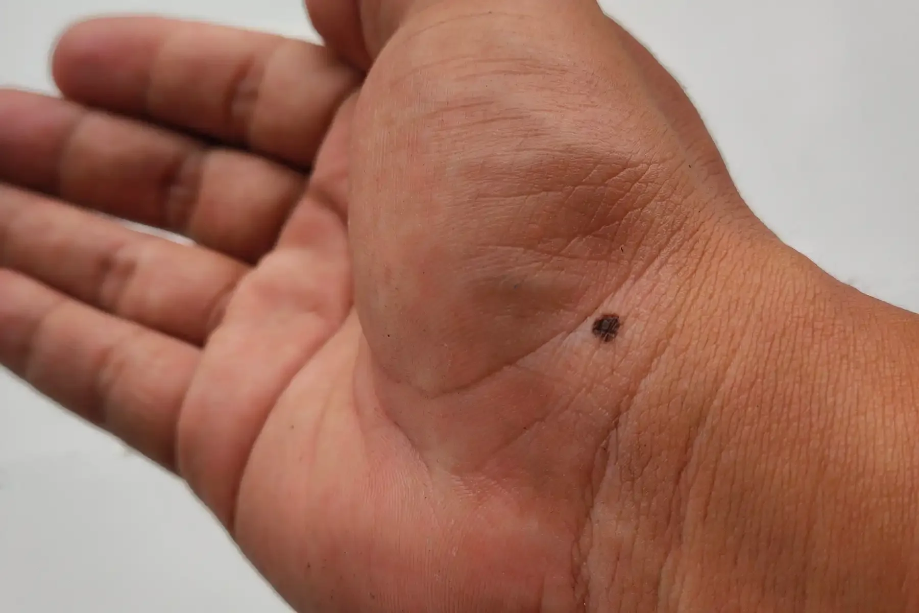 a small freckle on a wrist, the hand is also visible in the image