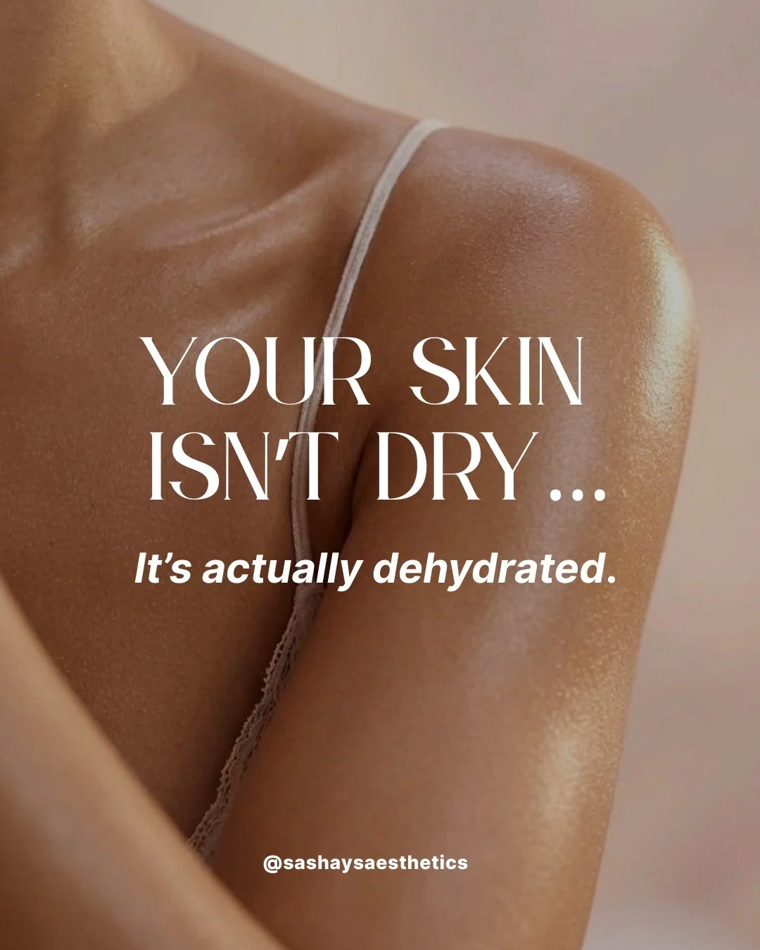 Hydration is the foundation of healthy skin. 💧

Swipe through to discover whether a Hydra infusion or Lifted02 Facial is the best choice for your dry skin concerns.