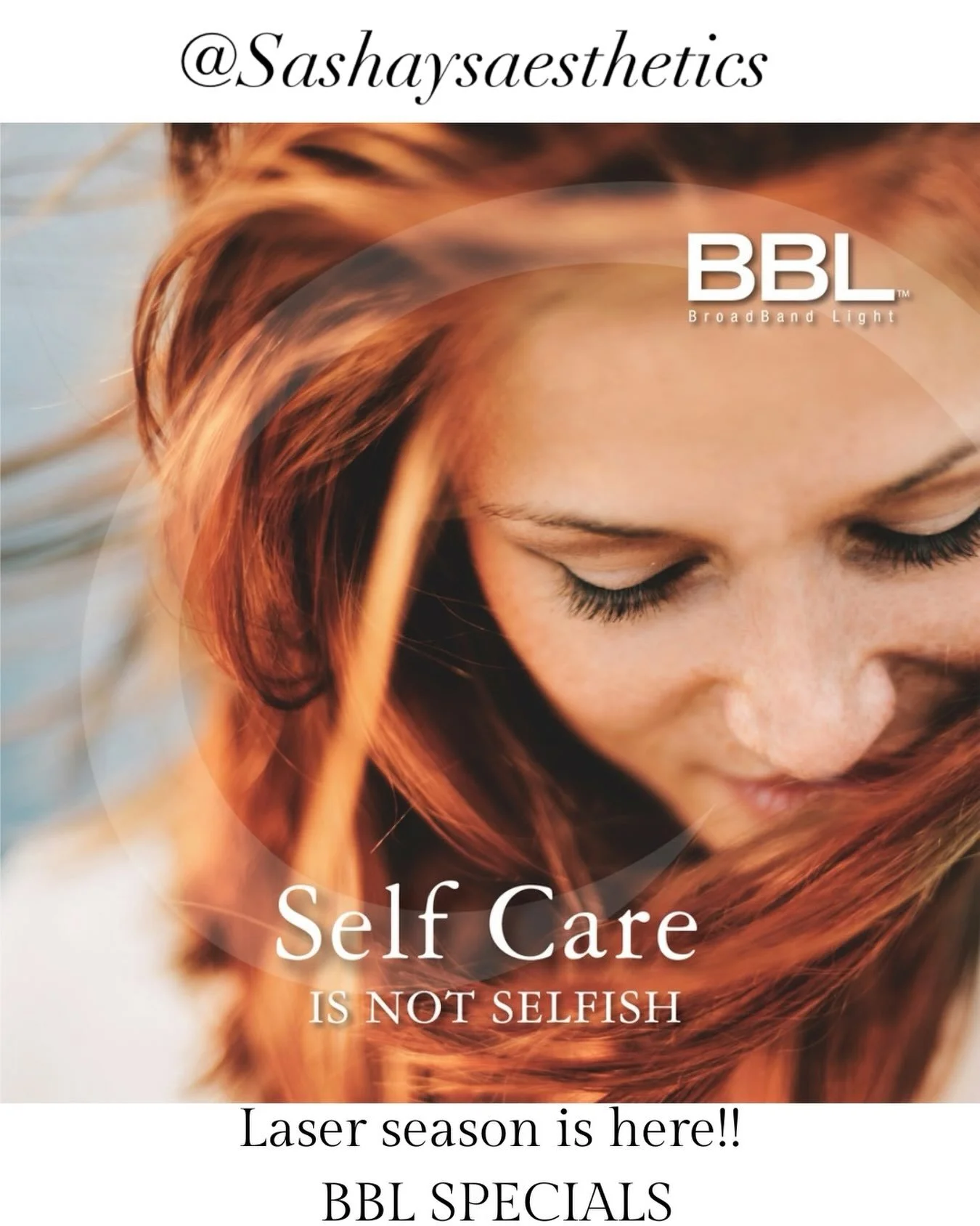 Are you looking in the mirror and noticing the Sundamage that your summer sun left behind? ☀️
Sciton BBL laser treatments can get rid of that!! 
Want to turn back the clock and age in reverse?? 🙌 Forever Young BBL, by Dr. Bitters does just that and 