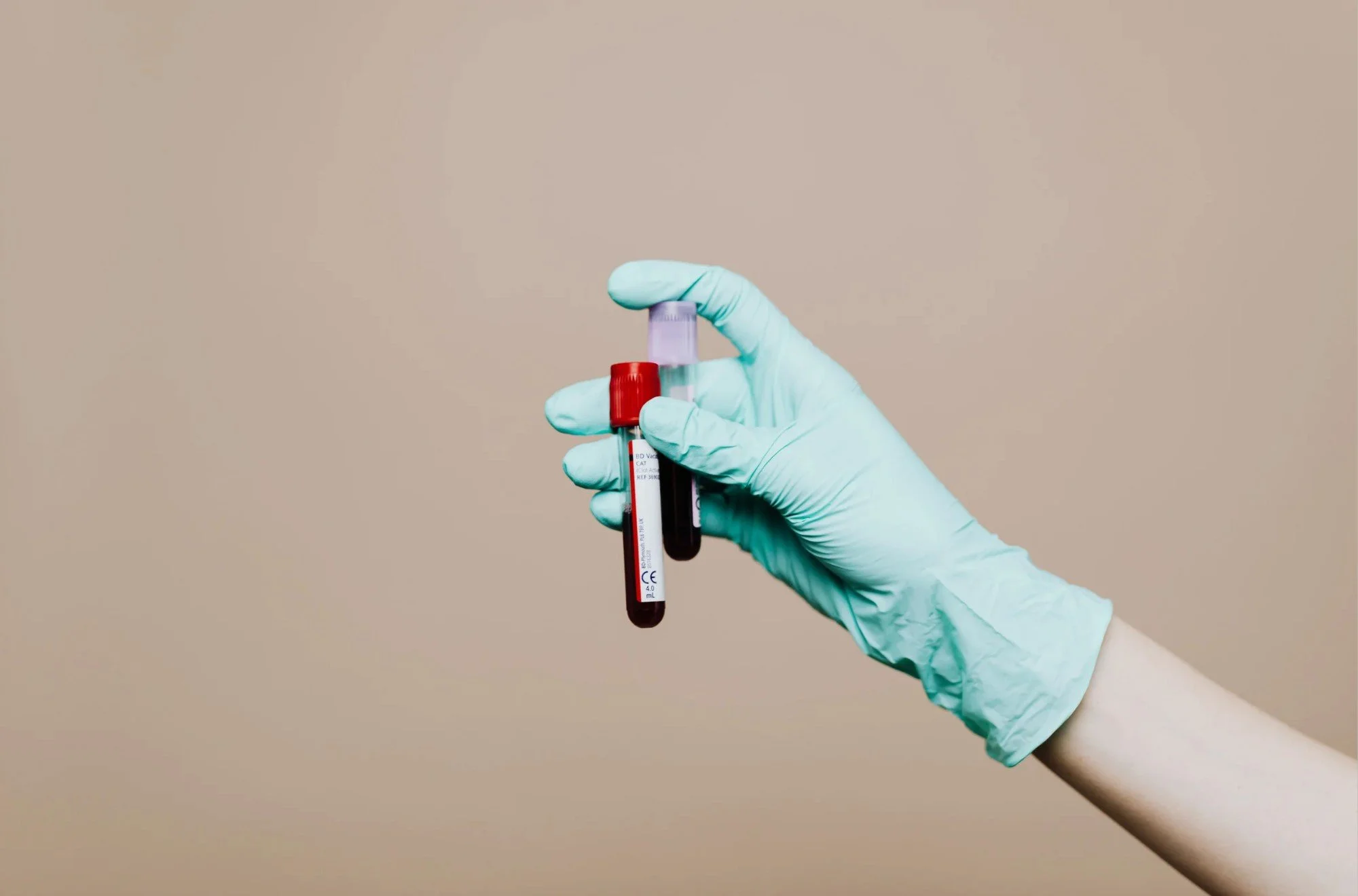 When Your Blood Work Is Normal... But You Still Don't Feel Well