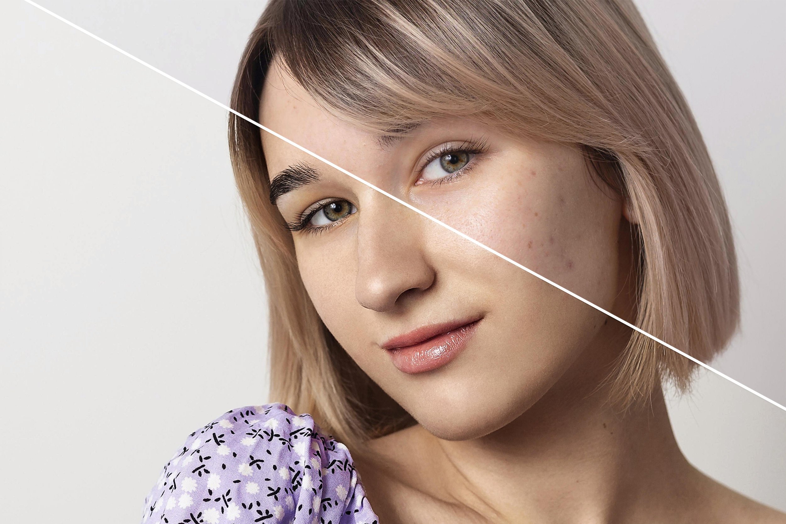 Pigmentation and Melasma Treatment in Singapore: What Actually Works