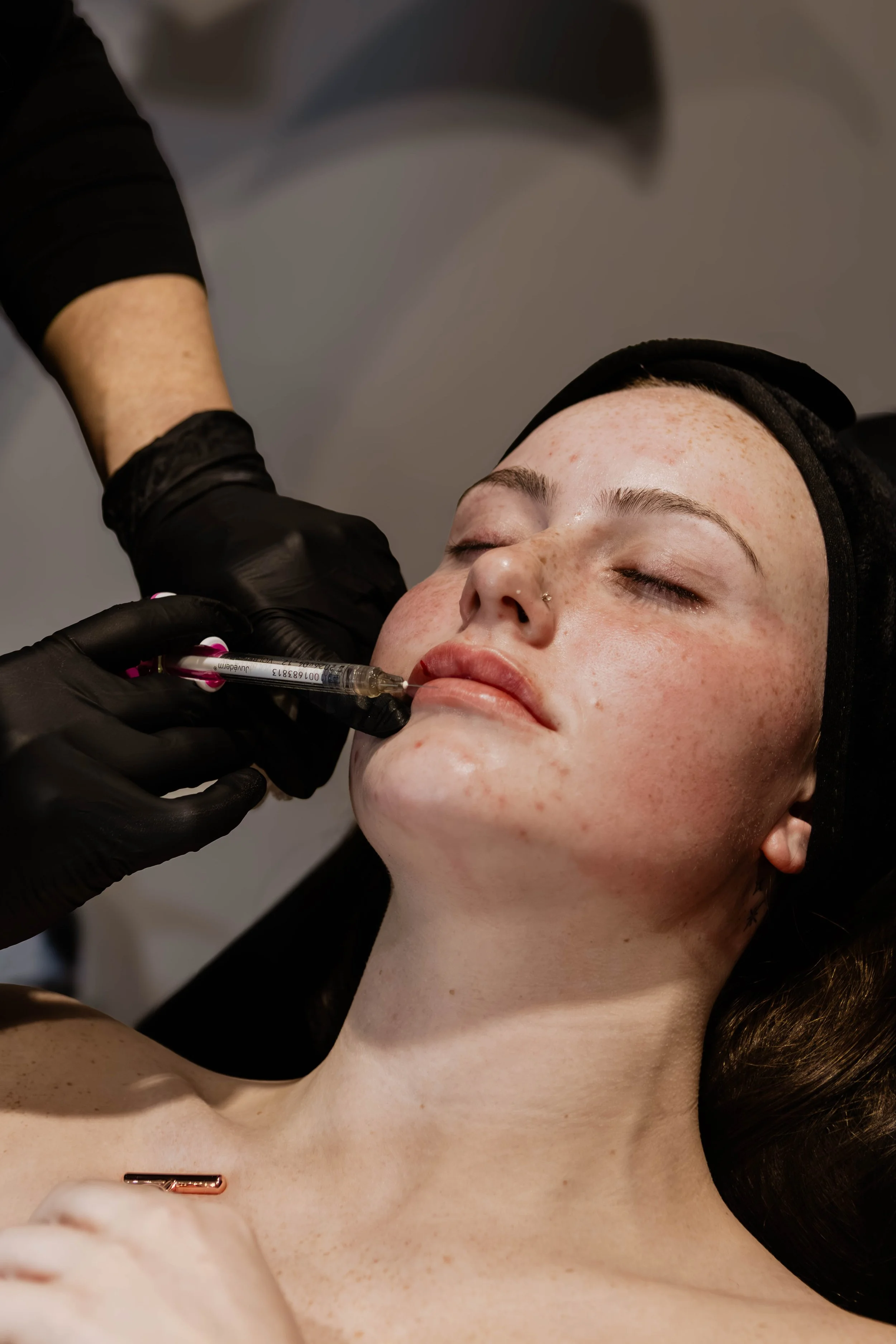 A woman with freckles and a nose piercing receiving a cosmetic injection in her lip from a practitioner wearing black gloves.
