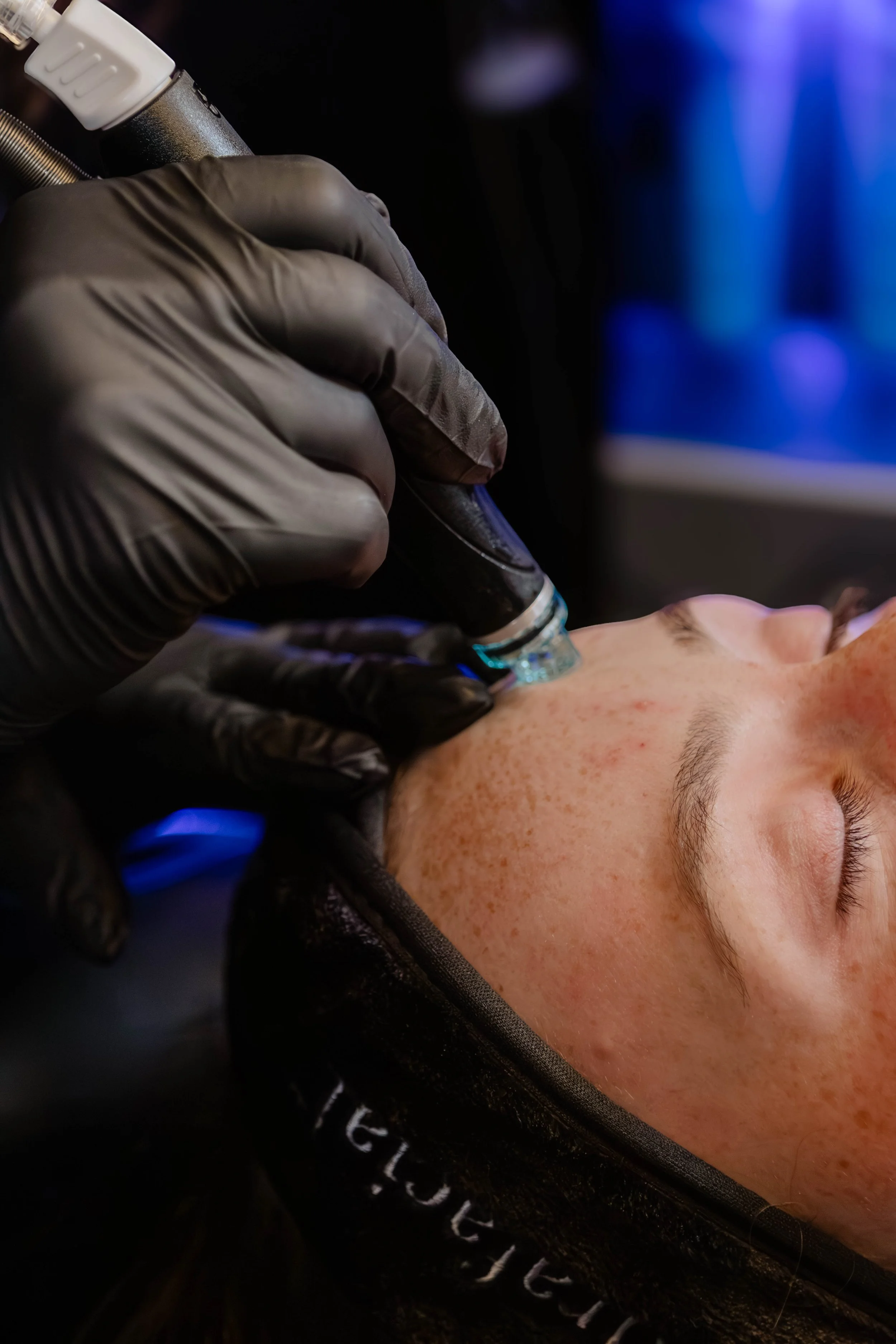 A person lying down with a closed eye, receiving a cosmetic treatment on their face using a small handheld device, with a technician wearing black gloves administering the procedure.