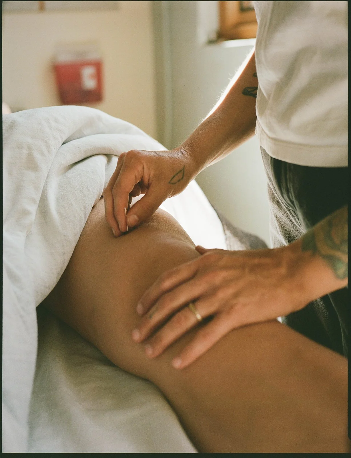 Acupuncture treatment in progress at Brooke Cannon Scott's Portland, OR classical Chinese medicine practice.
