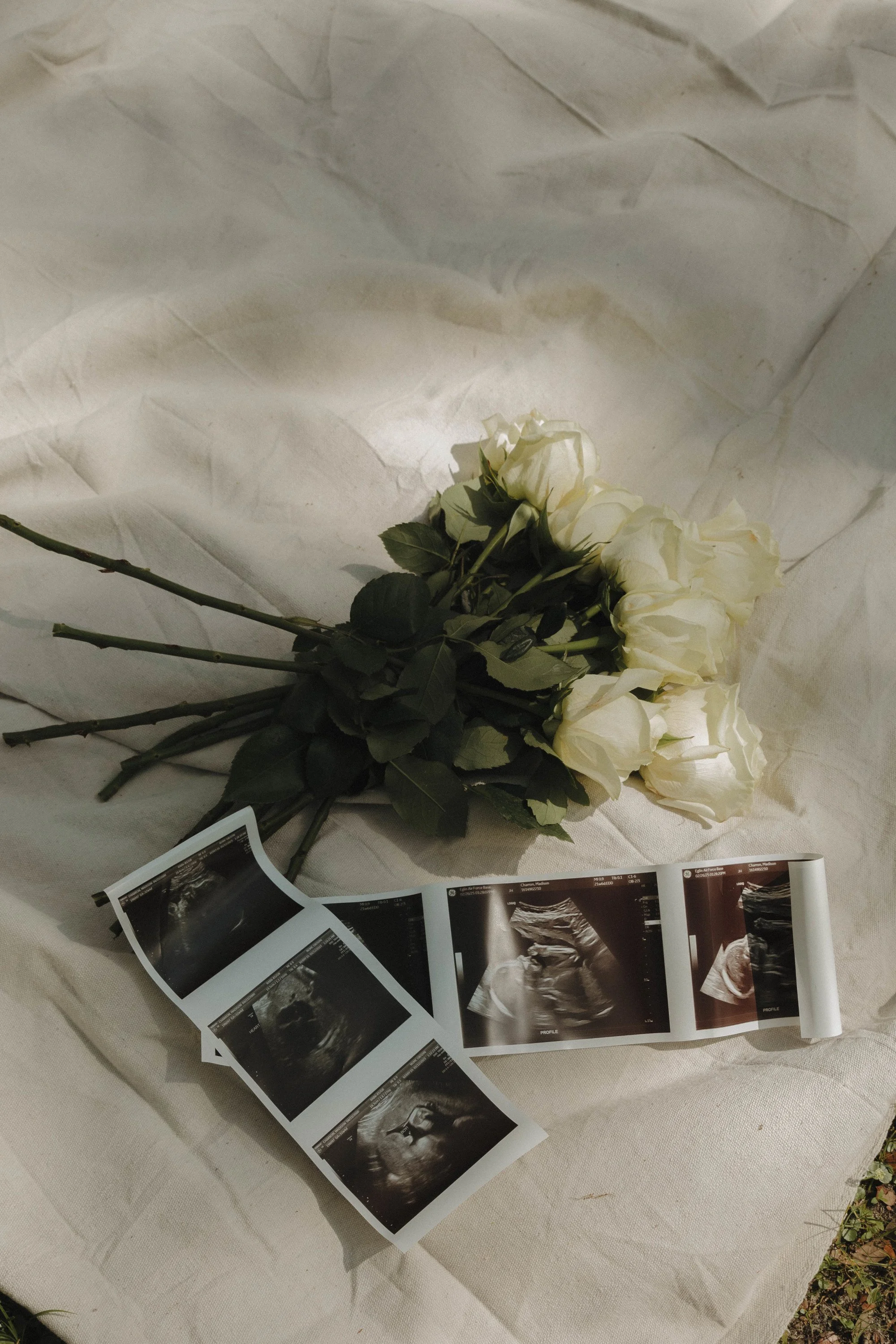 A bouquet of white roses lies on a white cloth, next to a series of ultrasound images.