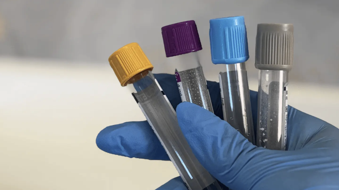 A gloved hand holding multiple blood sample tubes with colorful caps.