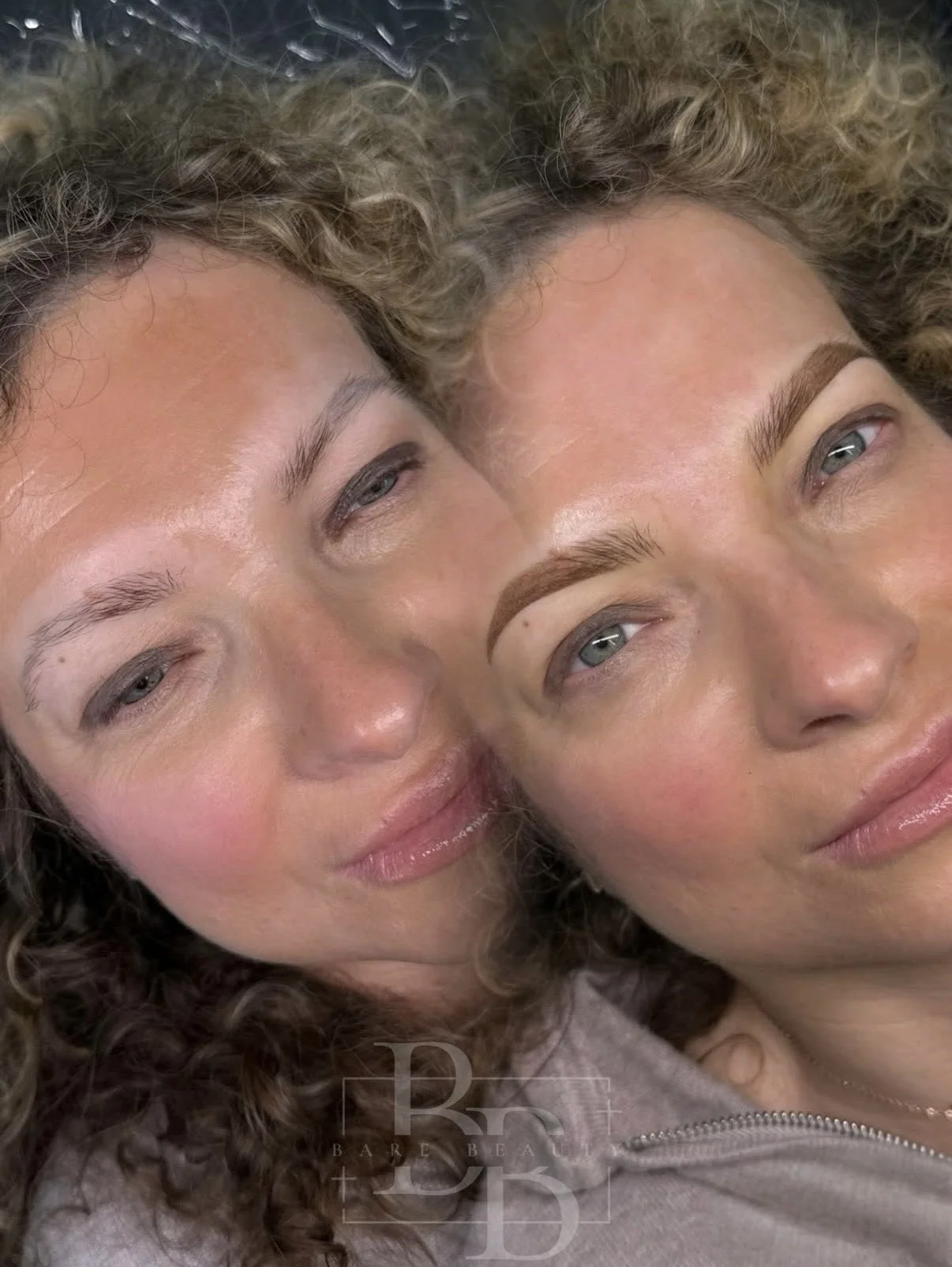 Brow Services