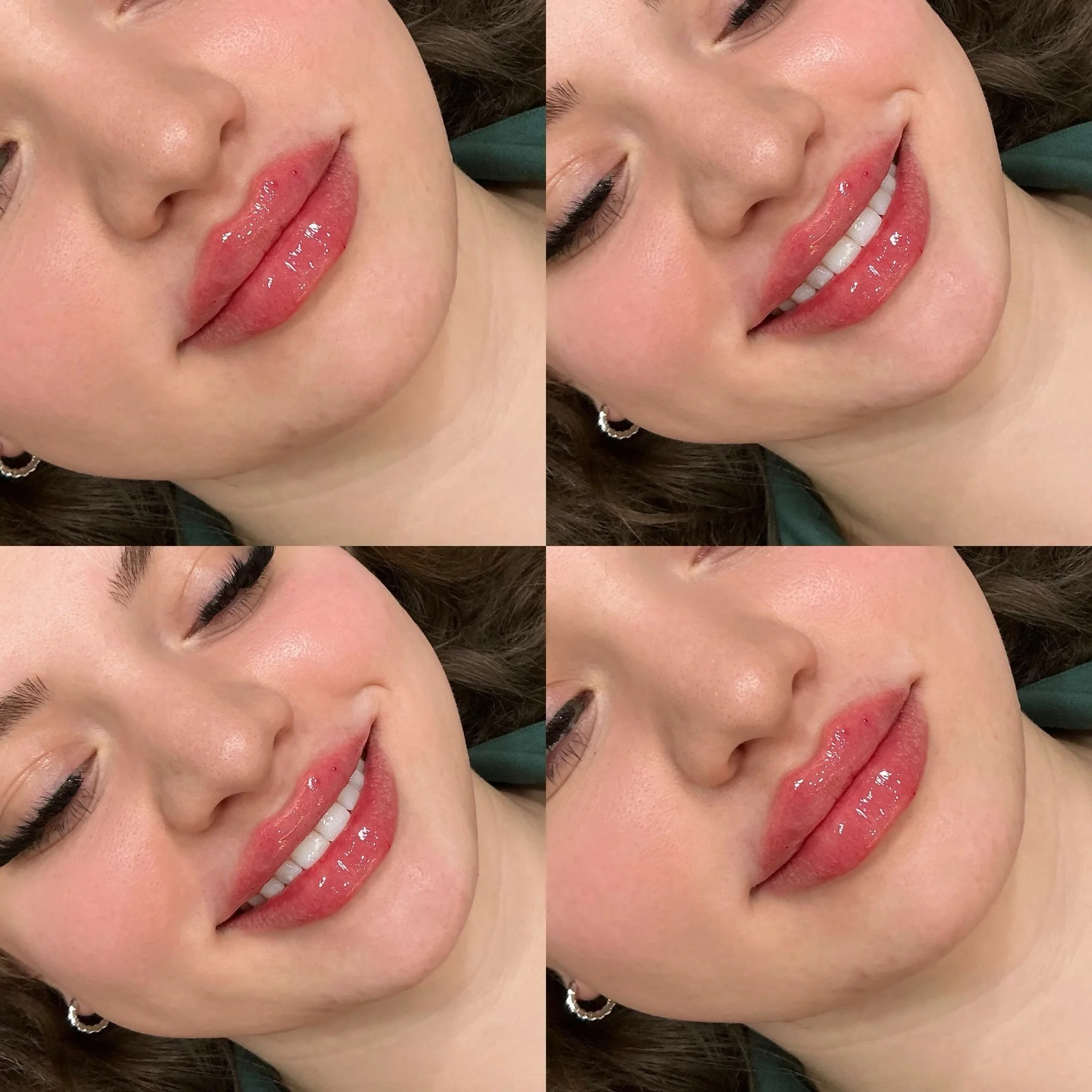 Lip filler. Beautifully maintained. What are you waiting for?⁣
⁣
To book: 501.236.4713 or click link in bio