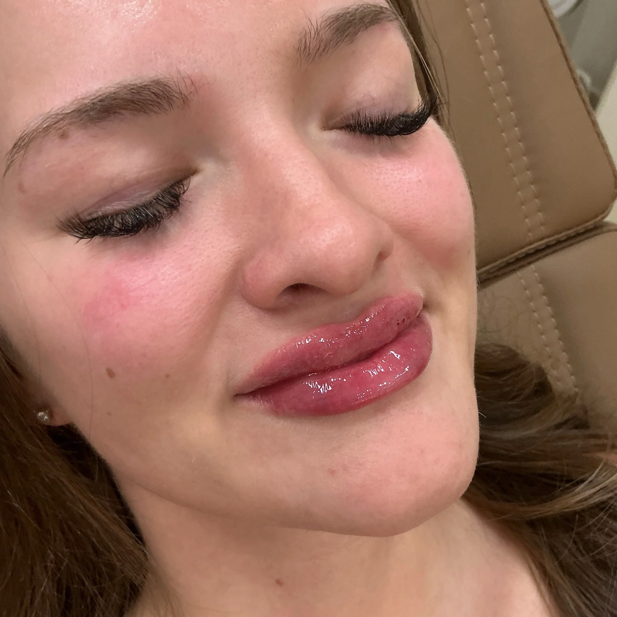 Lip filler can be oh so good! She wanted plump lippies. I delivered. Swipe to see the before photo. 👄