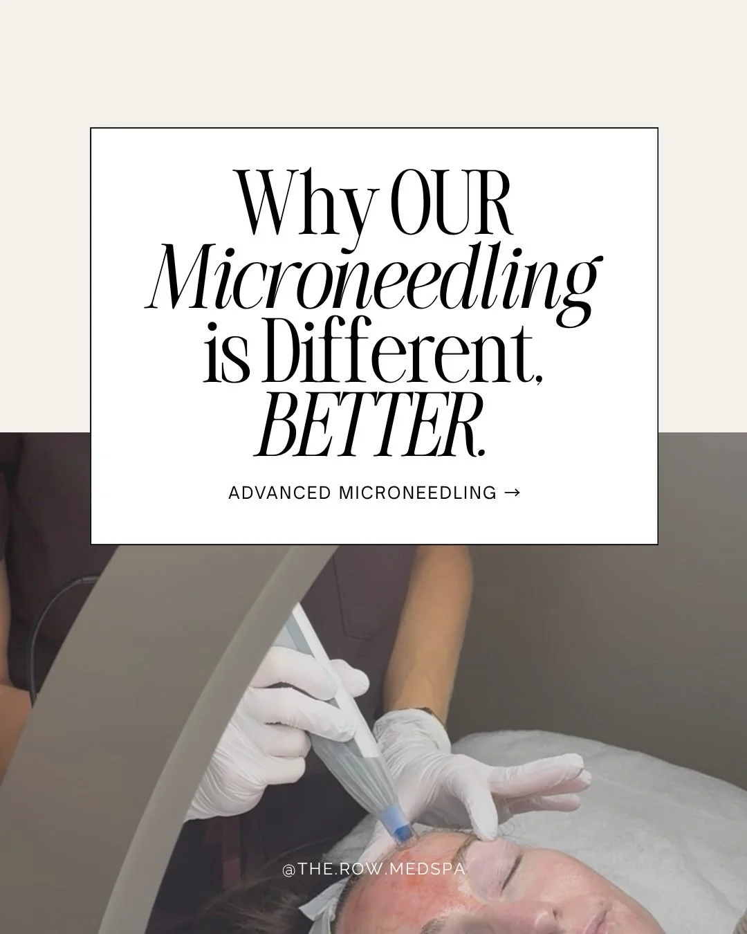 ✨ NOT ALL MICRONEEDLING IS CREATED EQUAL. ✨

At The Row, exceptional results begin with advanced technology, clinical expertise, and treatments tailored to your skin's unique needs.

Here's what makes our microneedling experience different. 🤎

✨ ADV
