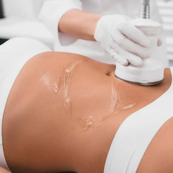 UltraSonic Fat Cavitation Service