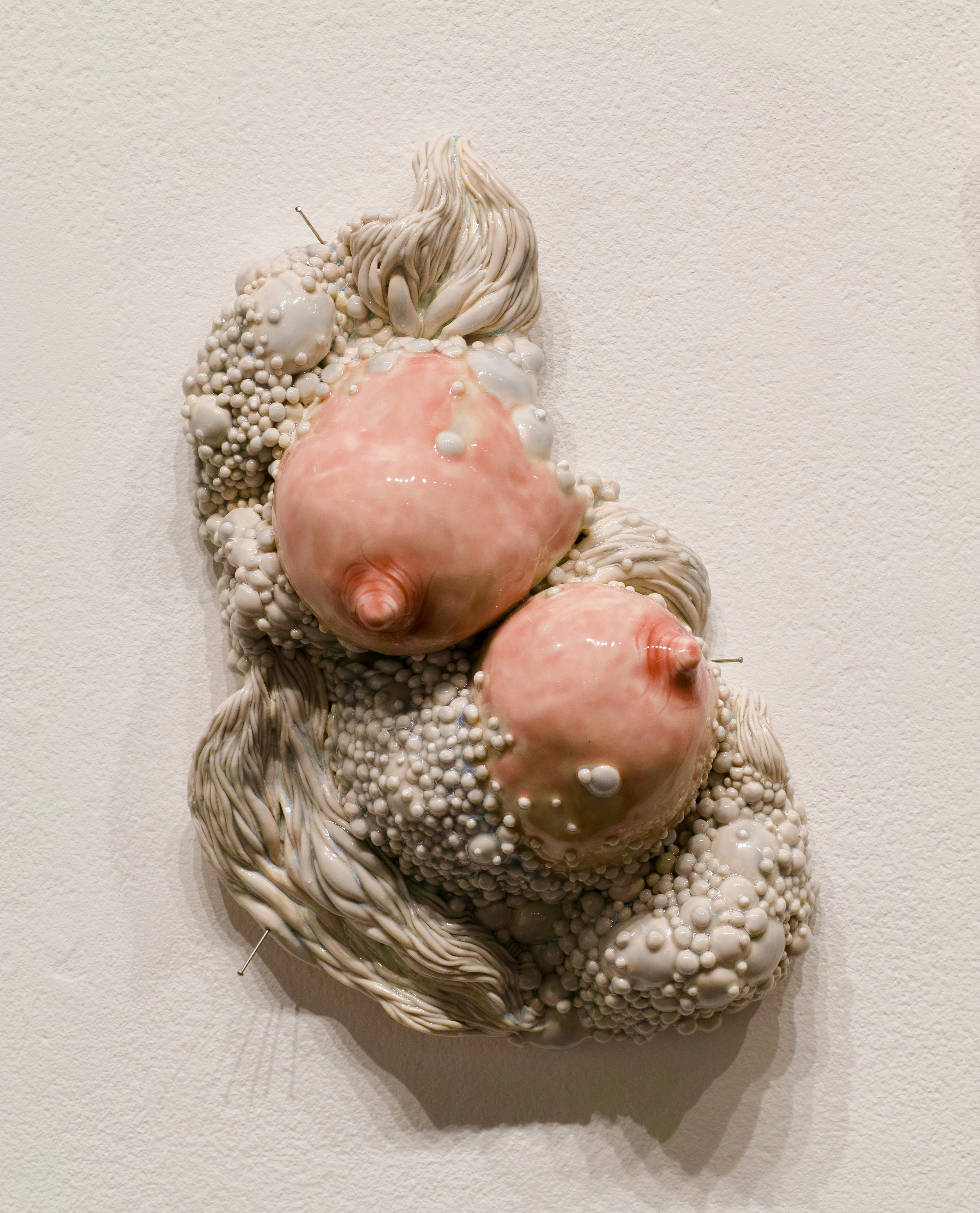 Ceramic wall sculpture of  breasts surrounded by blue-grey bumpy diseased flesh.