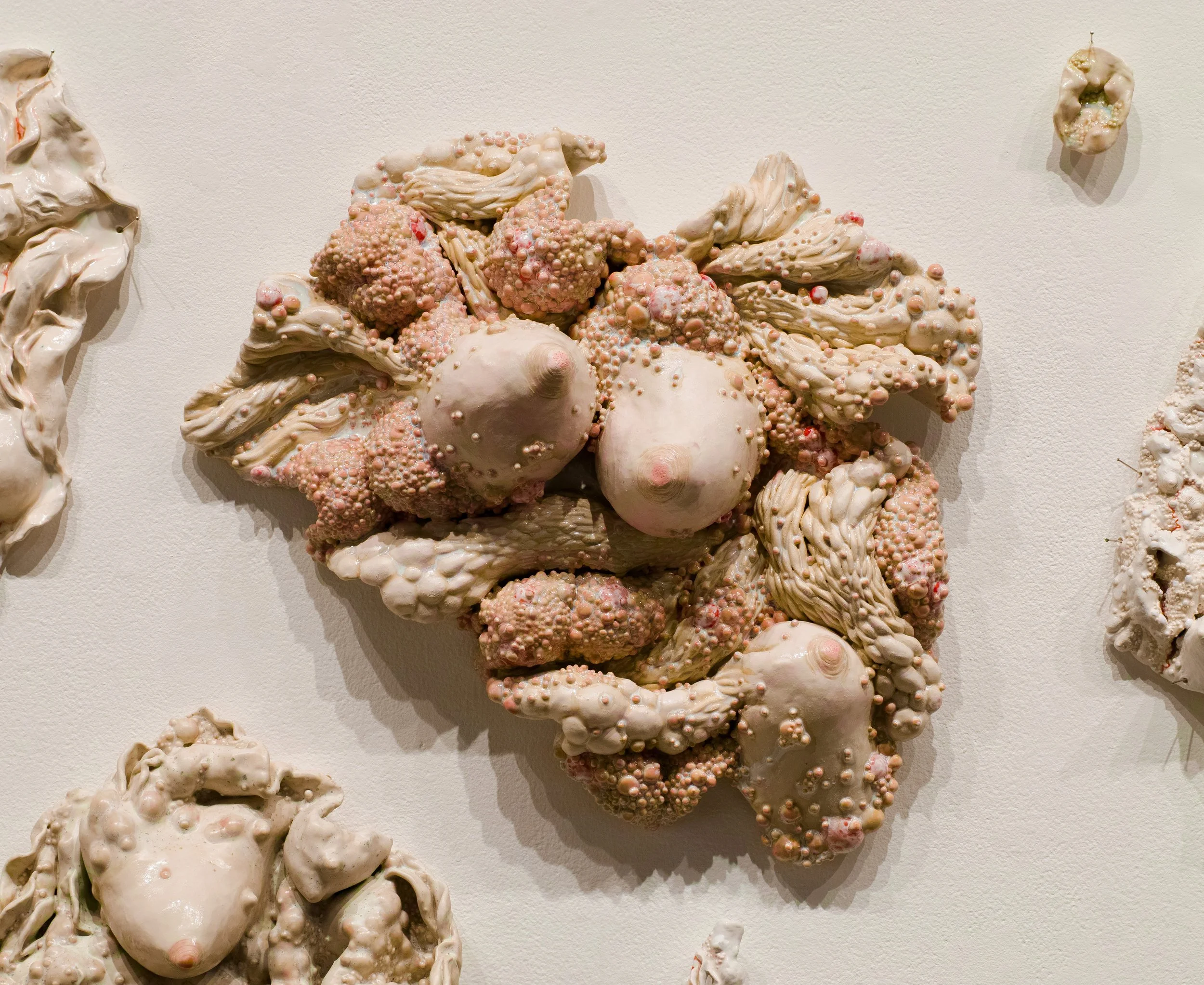 Ceramic wall sculpture of breasts surrounded by abstracted bumpy diseased flesh.
