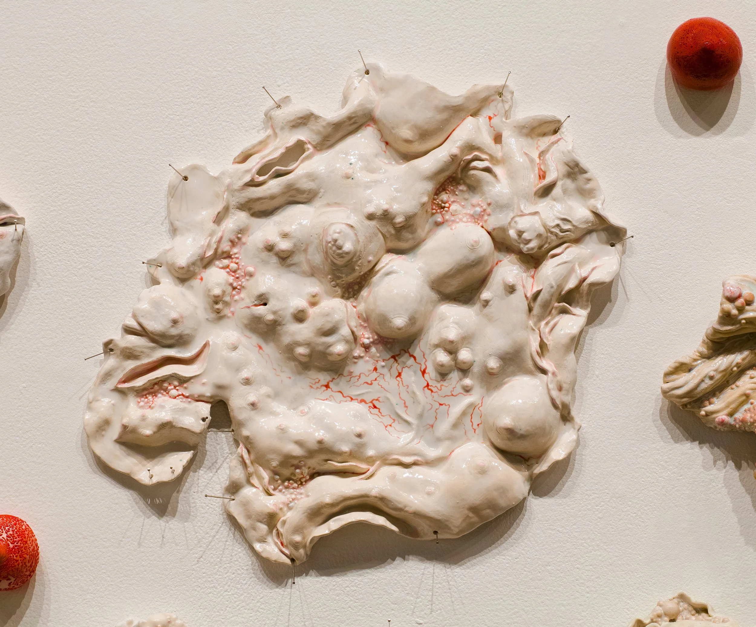 Ceramic wall sculpture of breasts surrounded by abstracted bumpy diseased flesh.