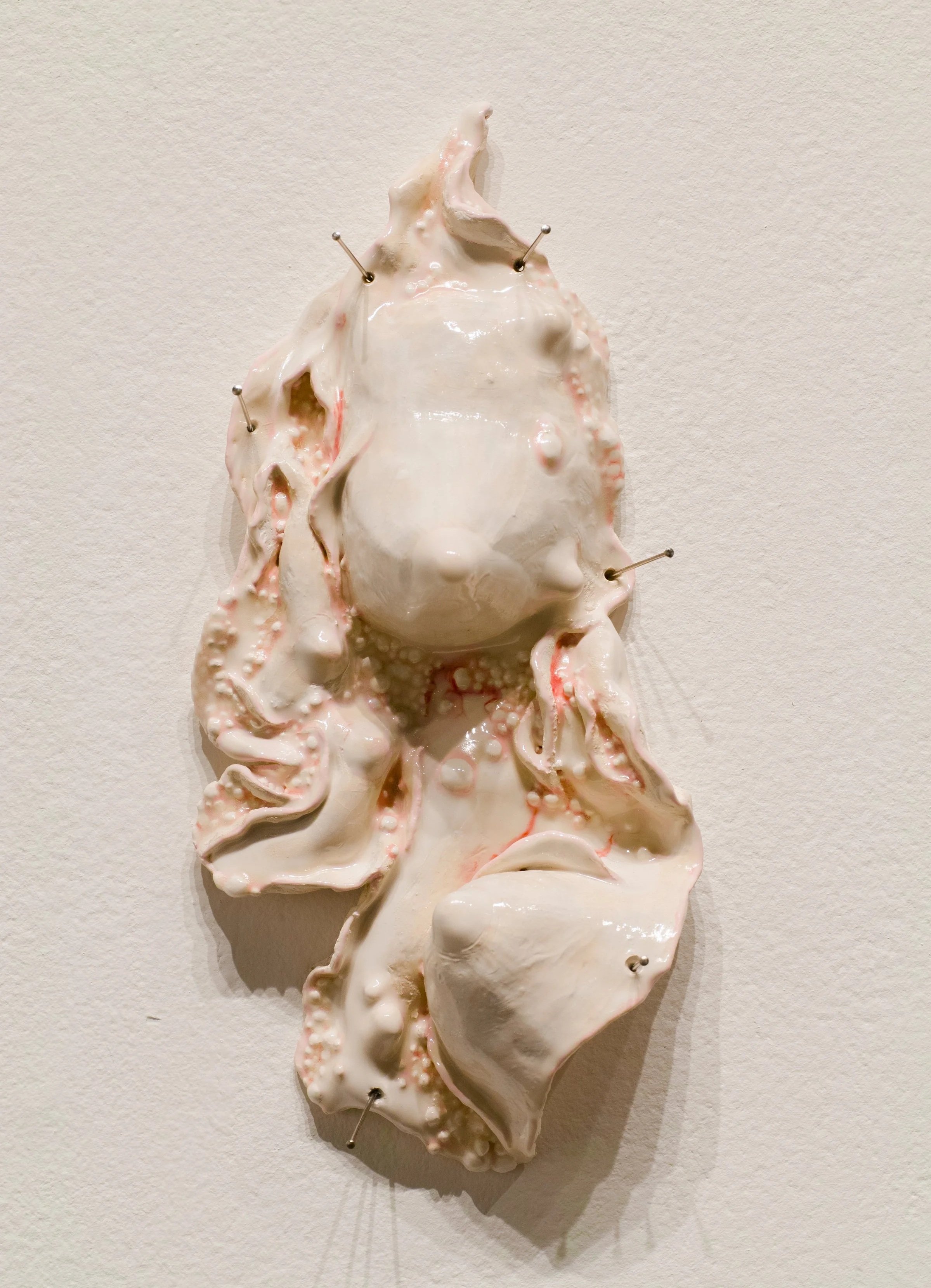 Ceramic wall sculpture of breasts surrounded by pink and cream bumpy diseased flesh.