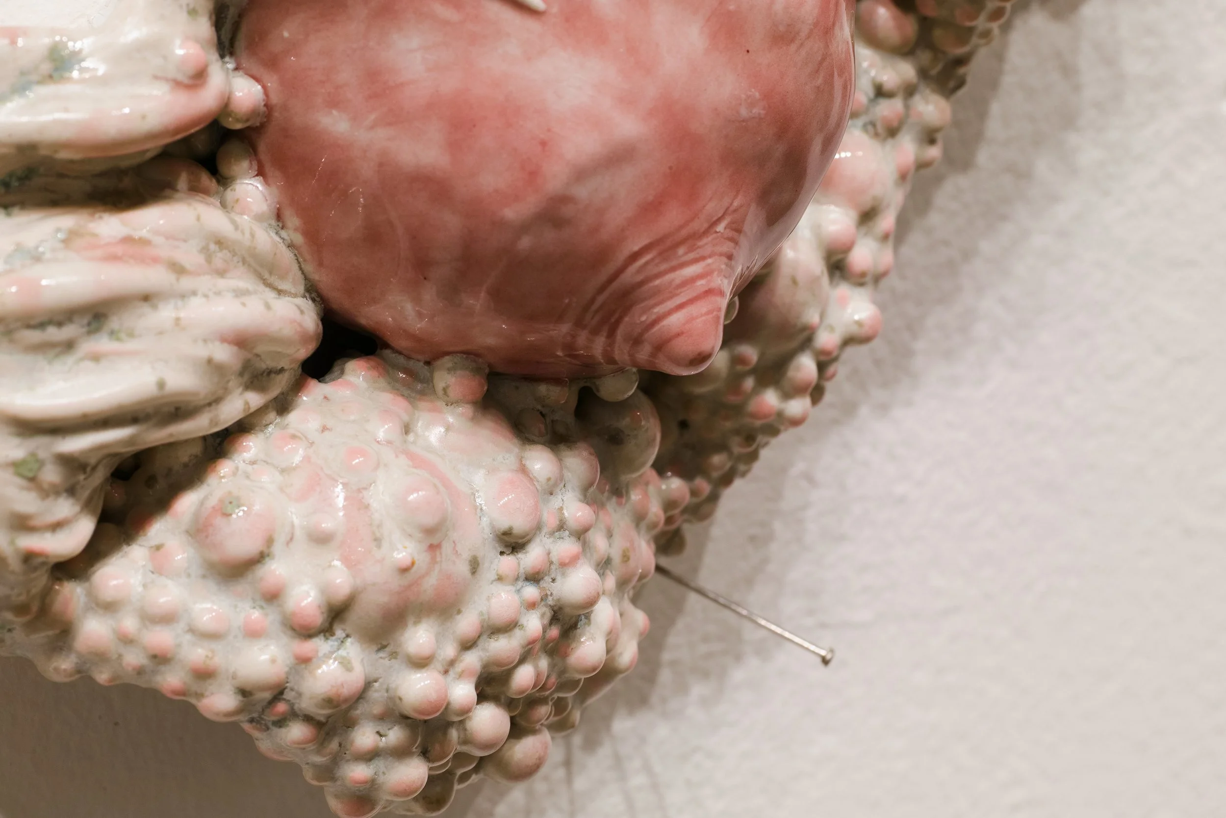 Close up of 	ceramic wall sculpture of breasts surrounded by abstracted bumpy diseased flesh.