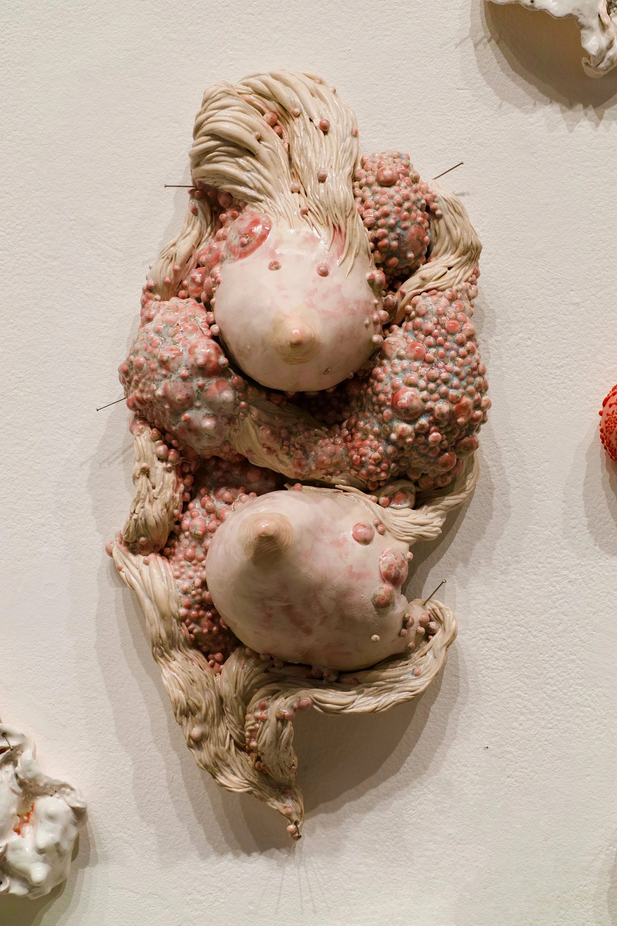 Ceramic wall sculpture of breasts surrounded by pink, cream, and greenish bumpy diseased flesh.