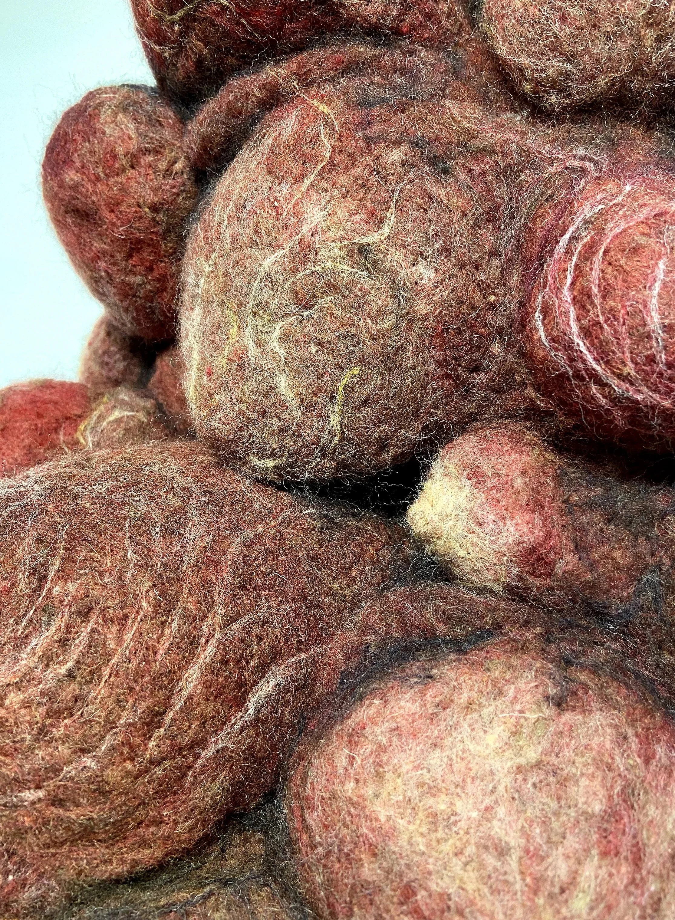 Close-up of multiple reddish-brown and black pimpled skin lesions with hair, possibly a skin condition.