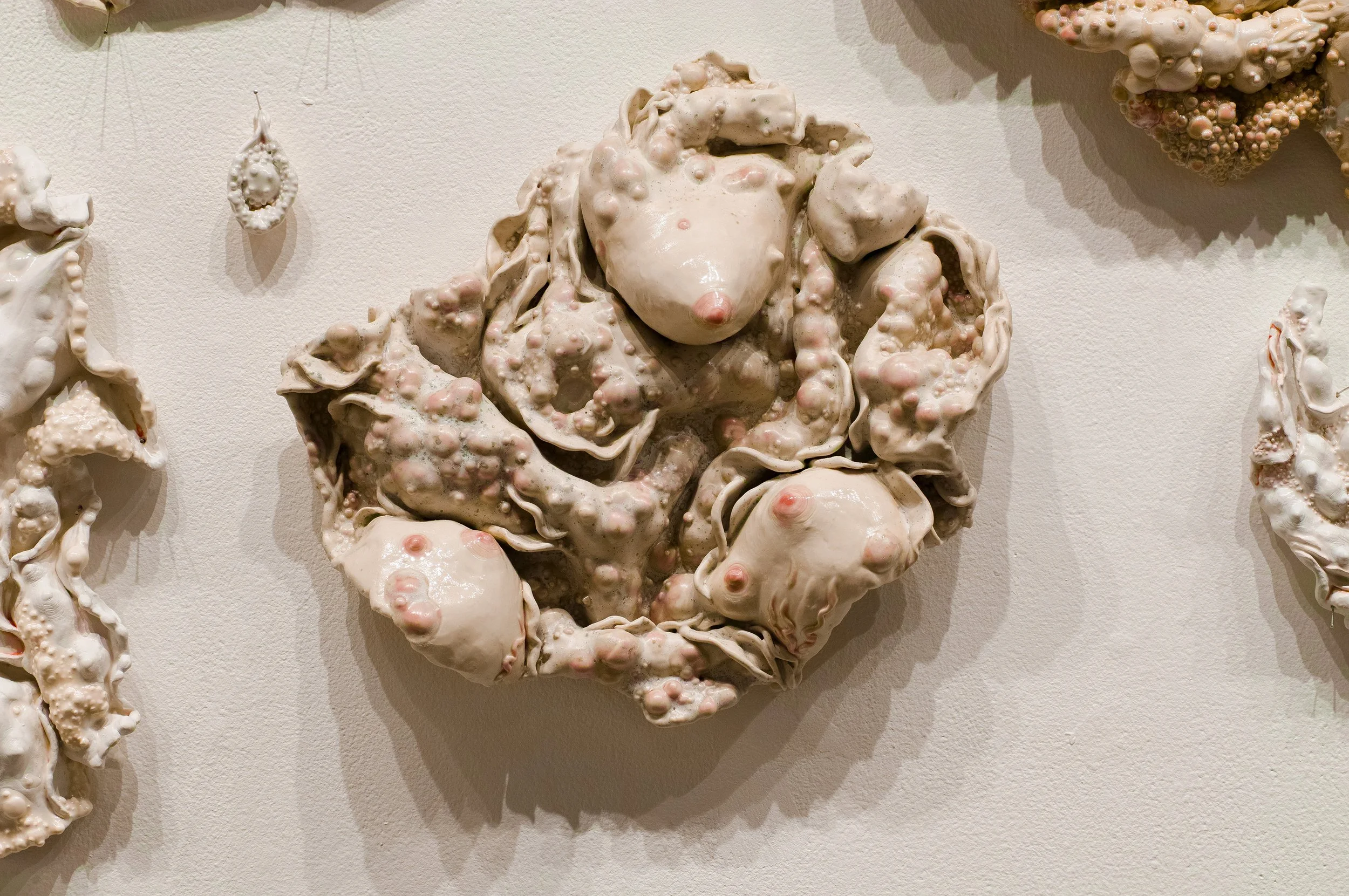 Ceramic wall sculpture of breasts surrounded by abstracted bumpy diseased flesh.