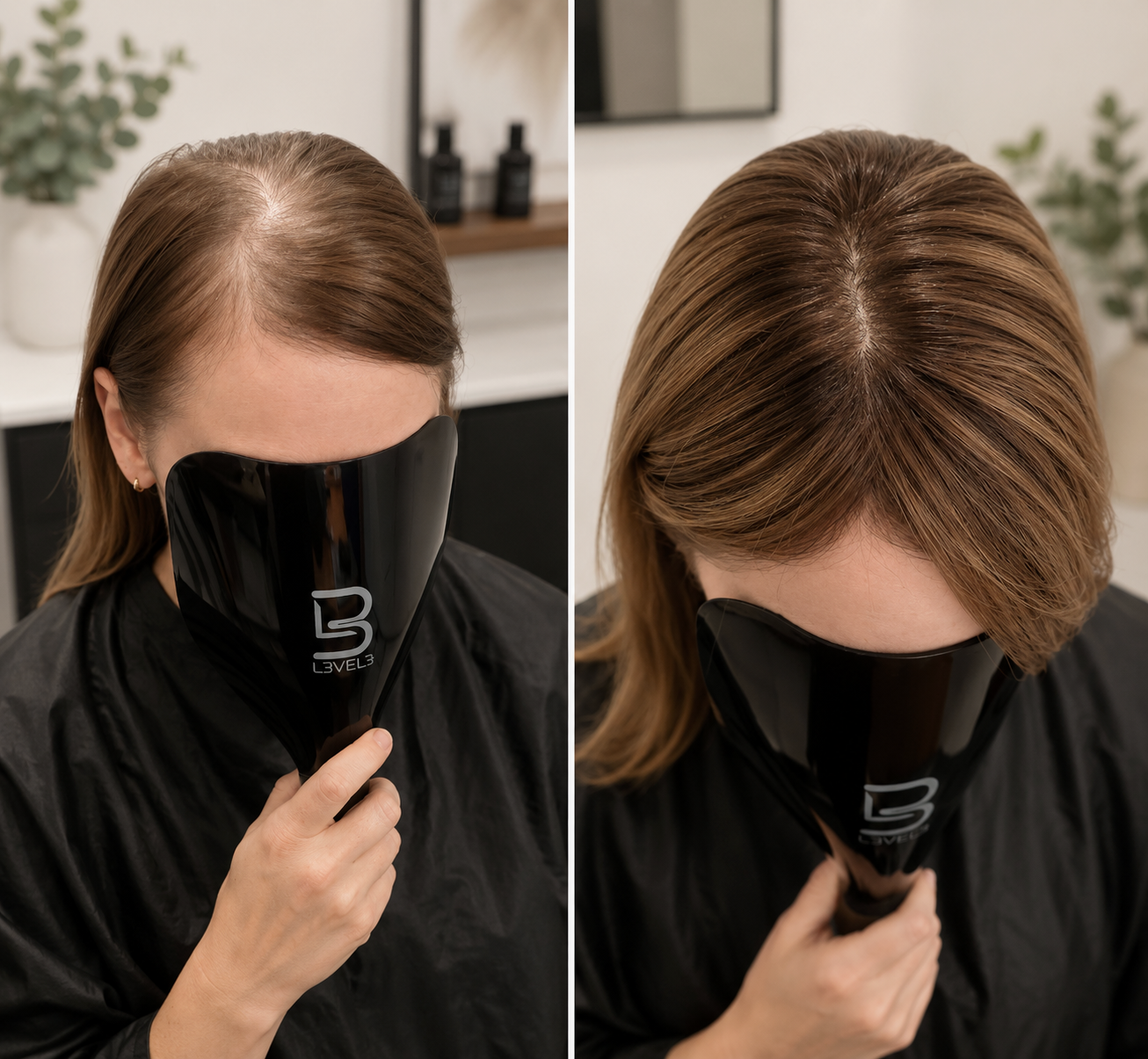 Before and after hair topper transformation, showing natural-looking coverage for thinning hair