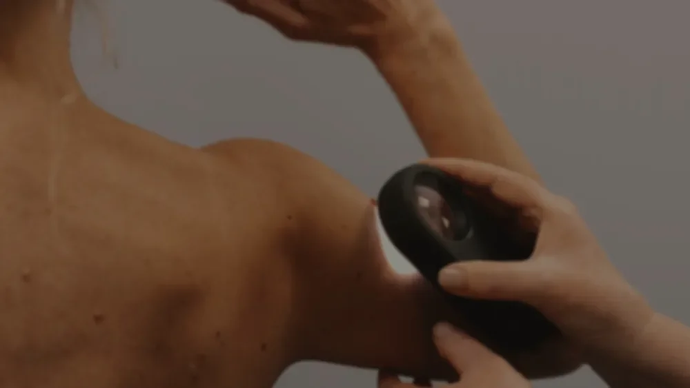 Professional skin examination using MoleMap imaging equipment at MoleMap Wigram