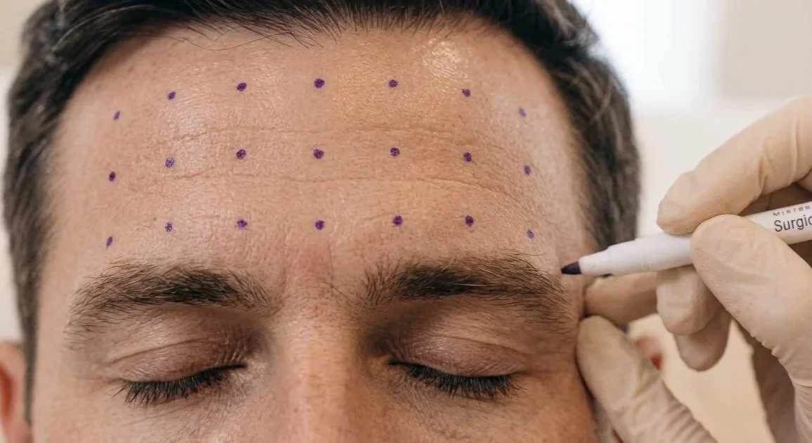 Anti wrinkle treatment at Modus Skin Lab in Bourne