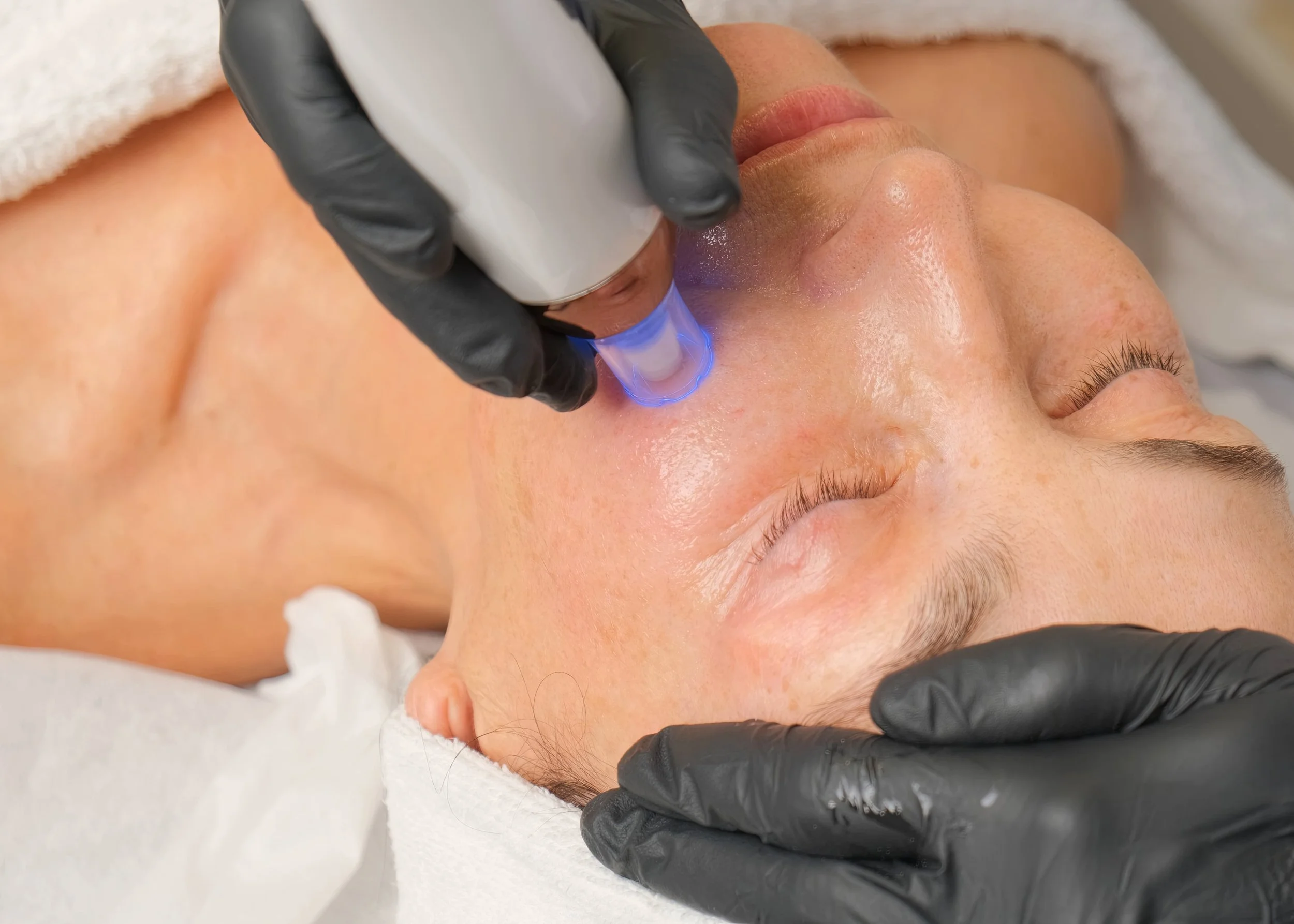 A person receiving a facial treatment, lying down with eyes closed, while a skincare professional applies a device to their face.
