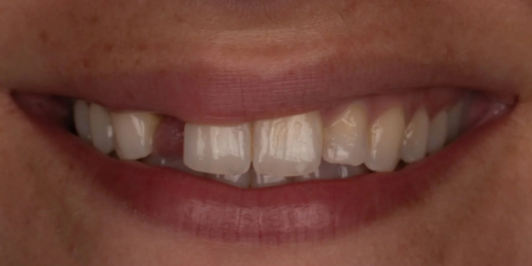 Close-up of a smiling person's mouth showing teeth and lips.