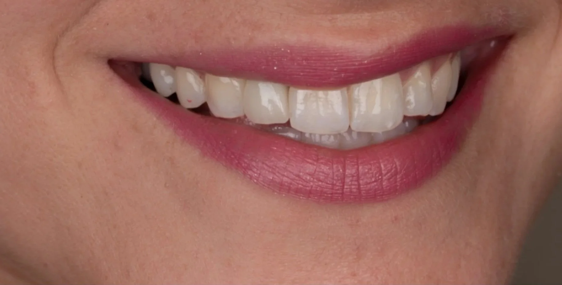Close-up of a person's smiling mouth showing white teeth and pink lips.