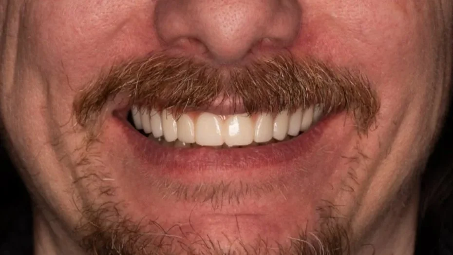 Close-up of a smiling man with a mustache and beard, showing white teeth.