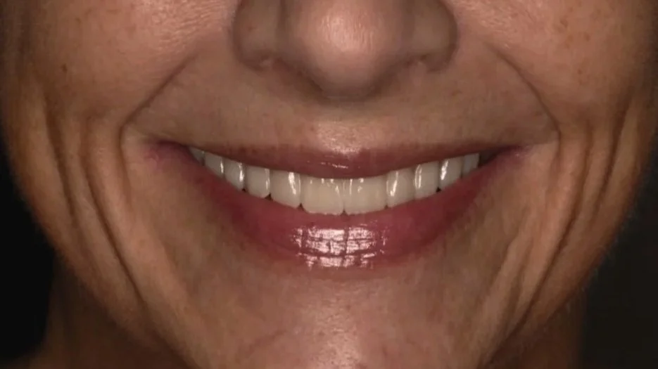 Close-up of a smiling person's mouth, showing teeth and lips.