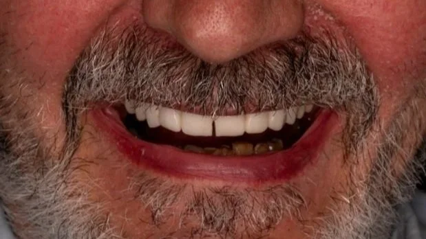 Close-up of a smiling person with a mustache and white teeth.