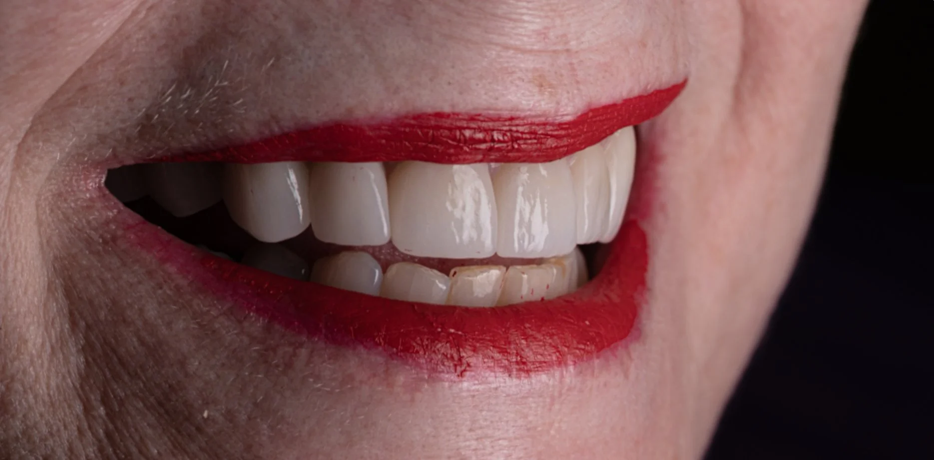 Close-up of a woman's smiling mouth with red lipstick showing her teeth and gums.