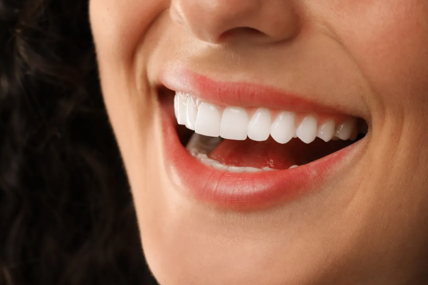 Close-up of a smiling woman's face showing white teeth and red lips.