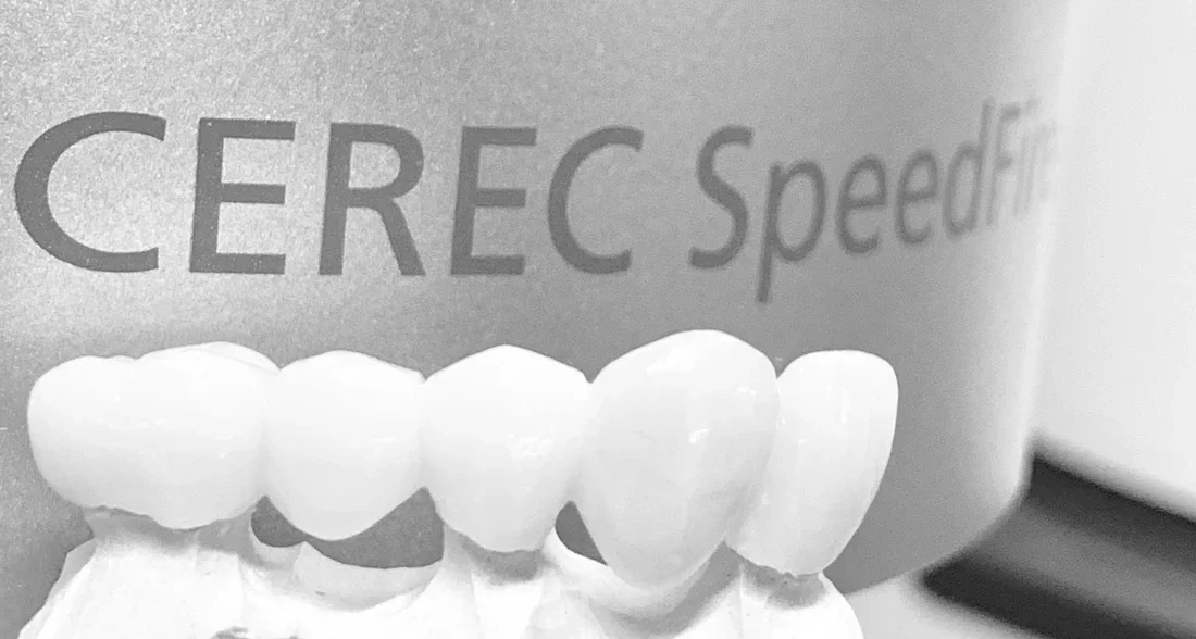 4 Common Causes of Toothaches