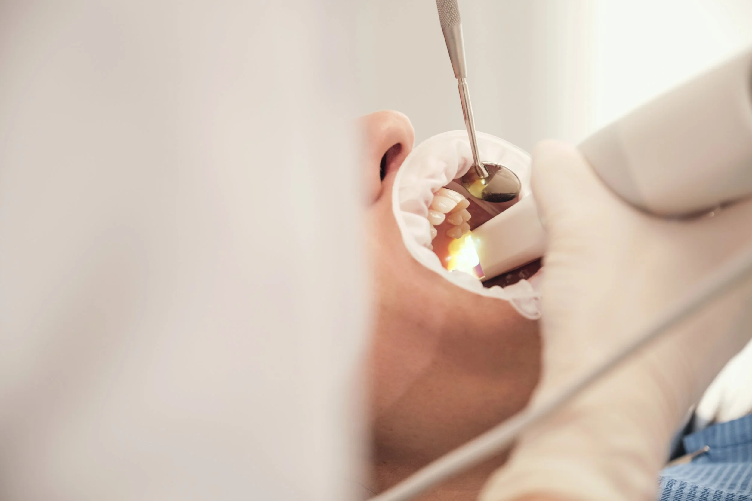 A close-up of a dental procedure with a patient’s mouth open and a dental tool inside, focusing on teeth and gums.