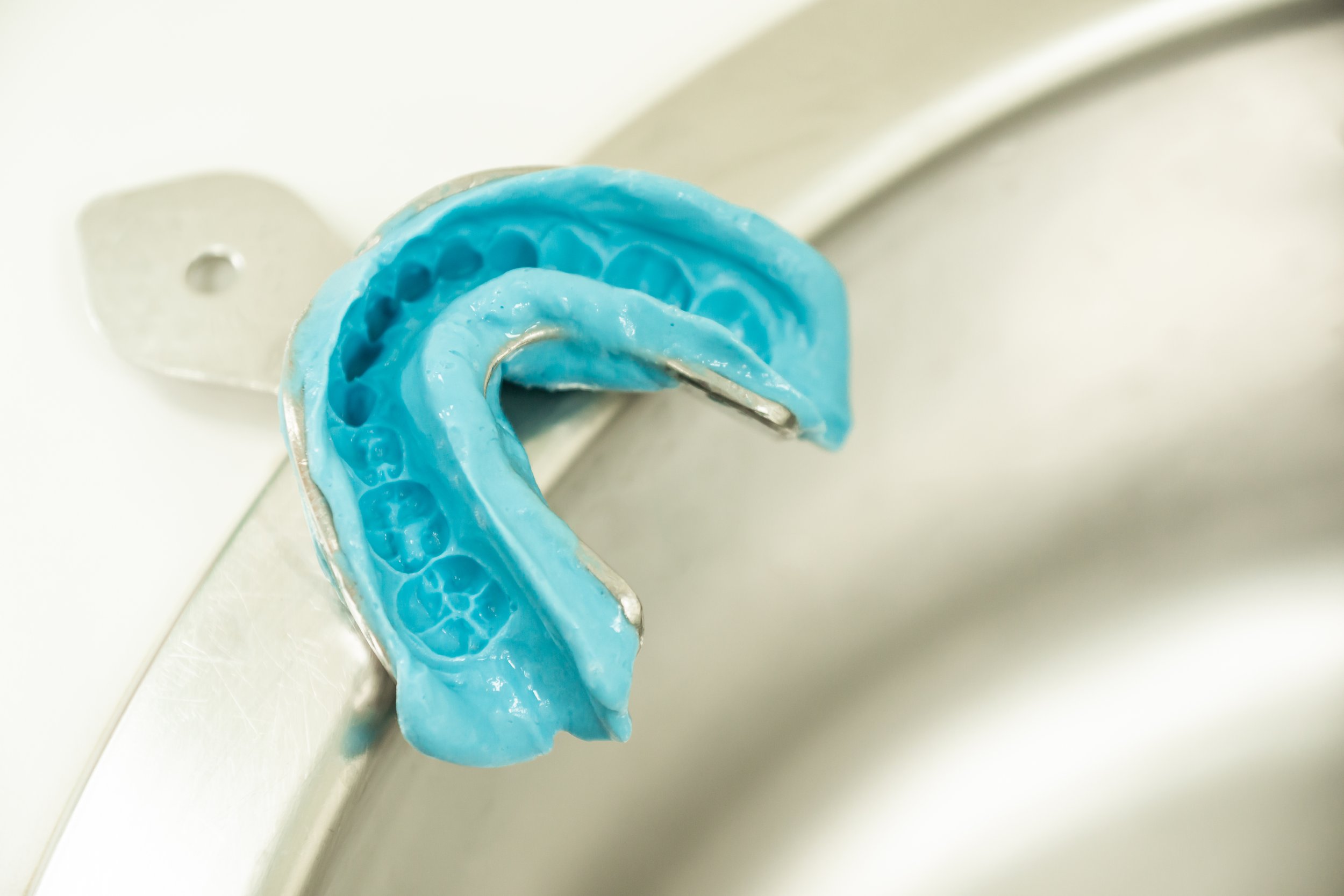 Close-up of a blue dental impression tray with blue impression material inside, resting on a white dental sink or countertop.