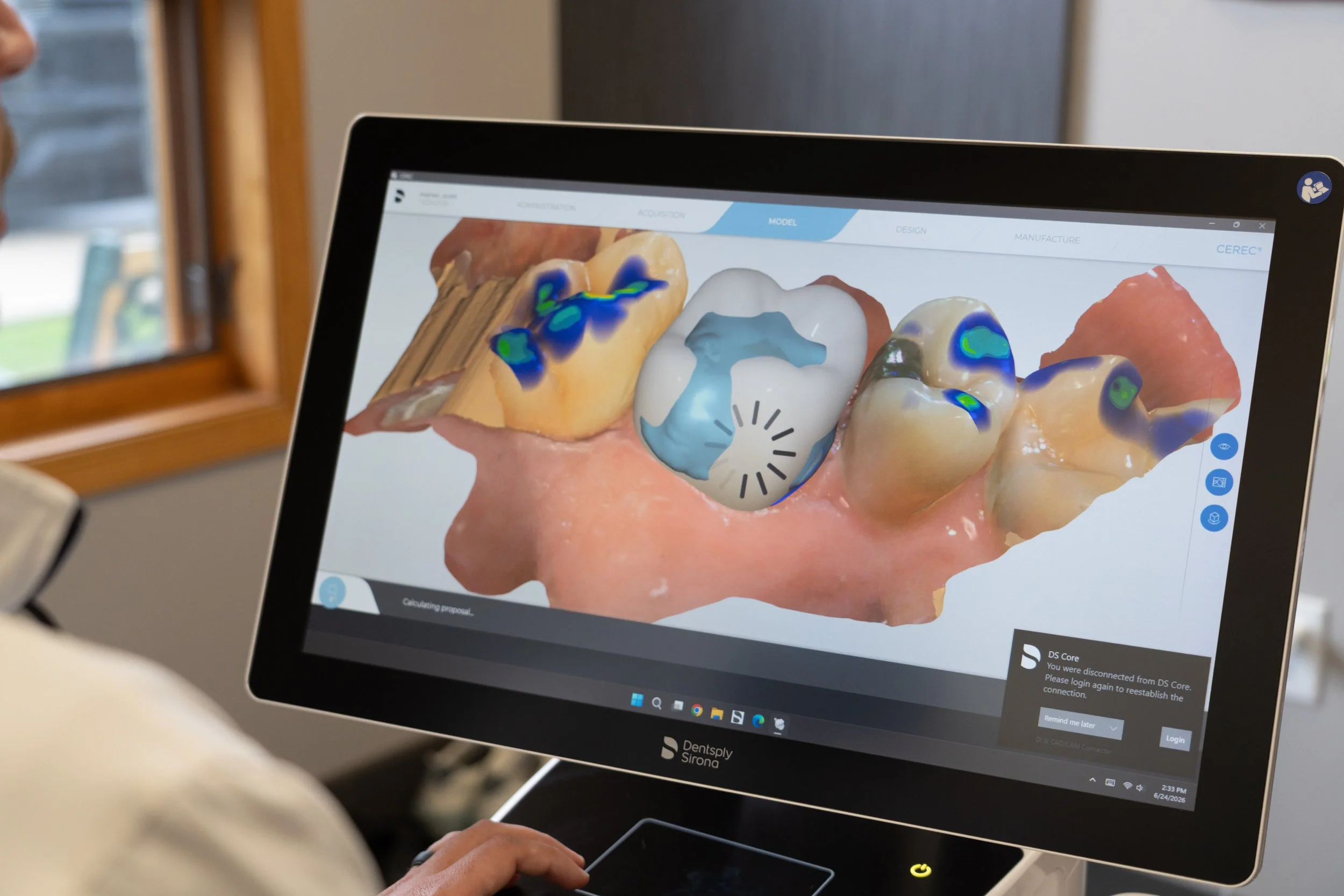A computer screen displaying a digital dental model with several teeth, some with color-coded areas indicating areas of interest or concern, and a loading icon in the middle.