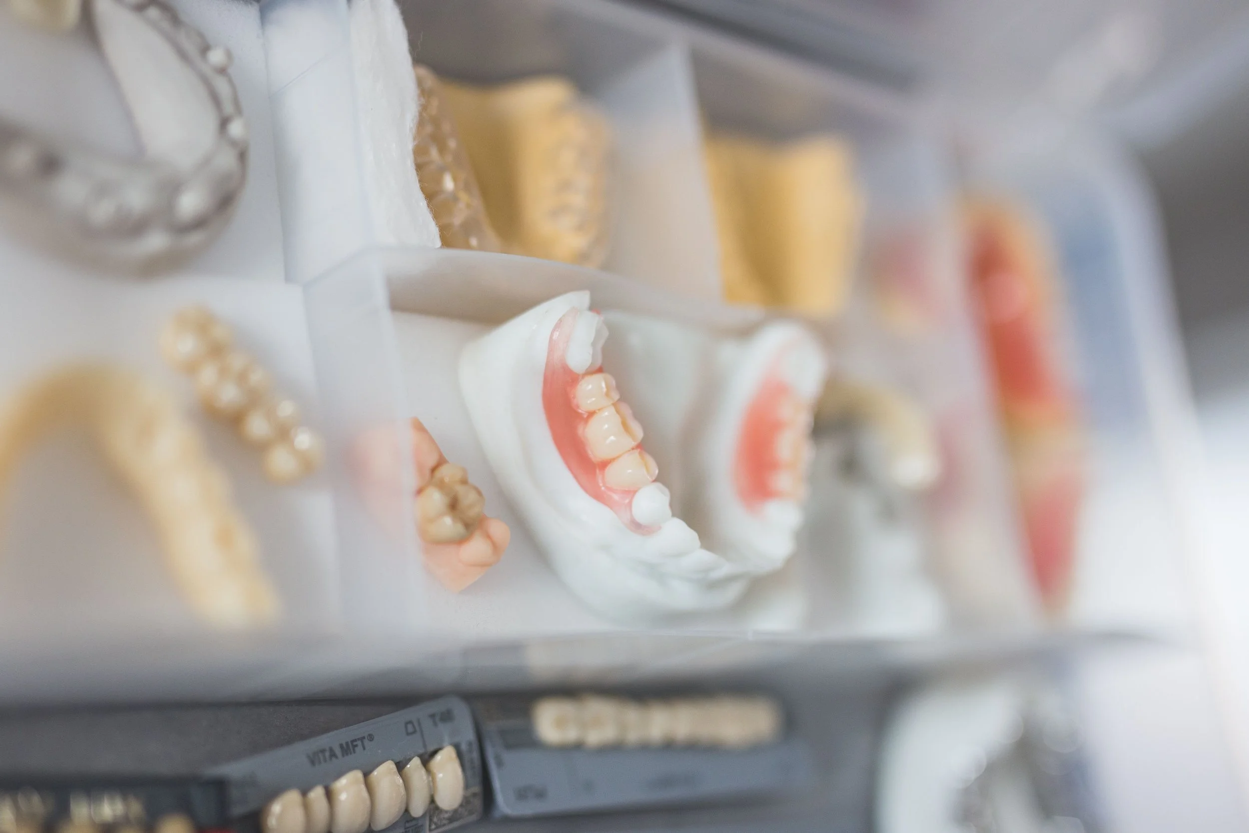 Close-up of dental models, showing various sets of artificial teeth, including upper and lower arches with different shades and structures, in a dental office or clinic setting.