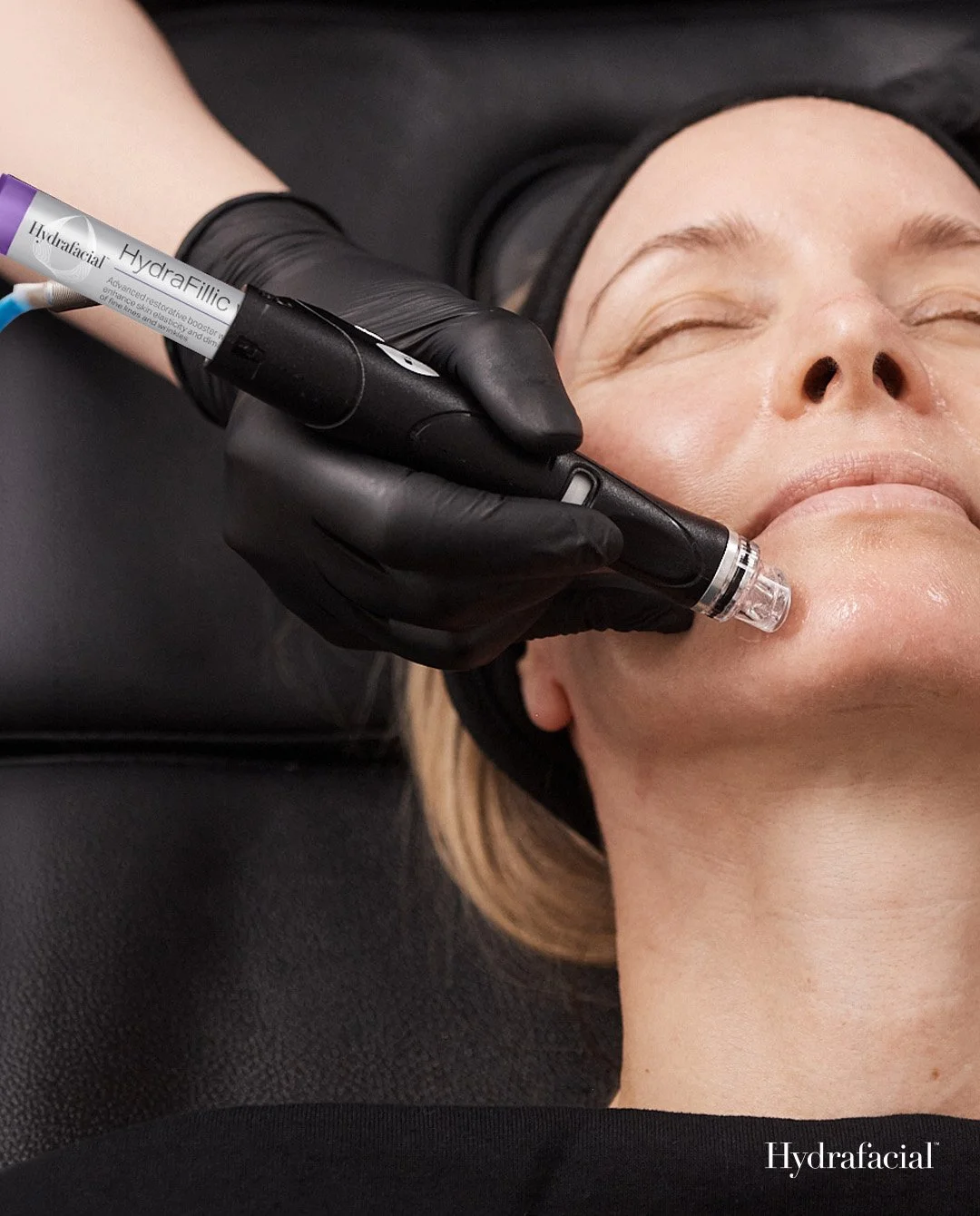 Deluxe Hydrafacial - 3 Treatments