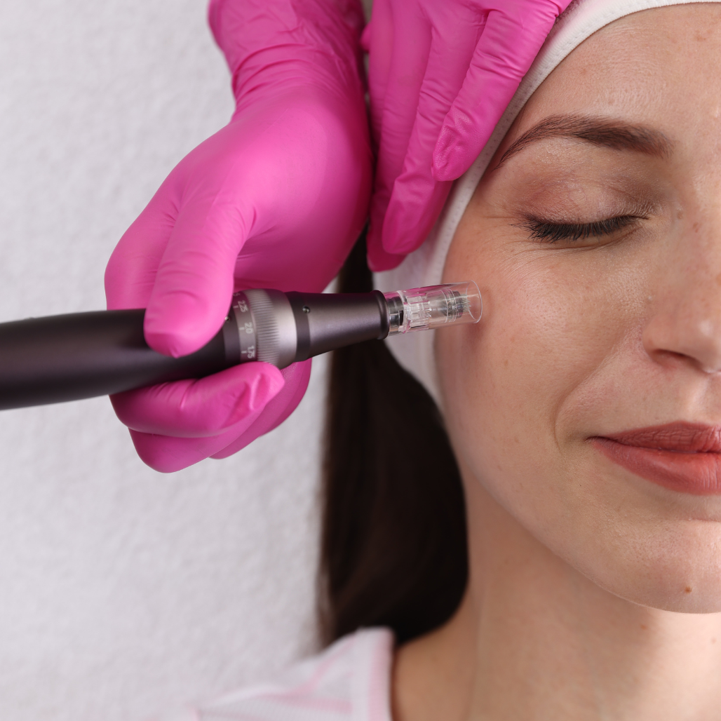 Basic Microneedling Package of 3