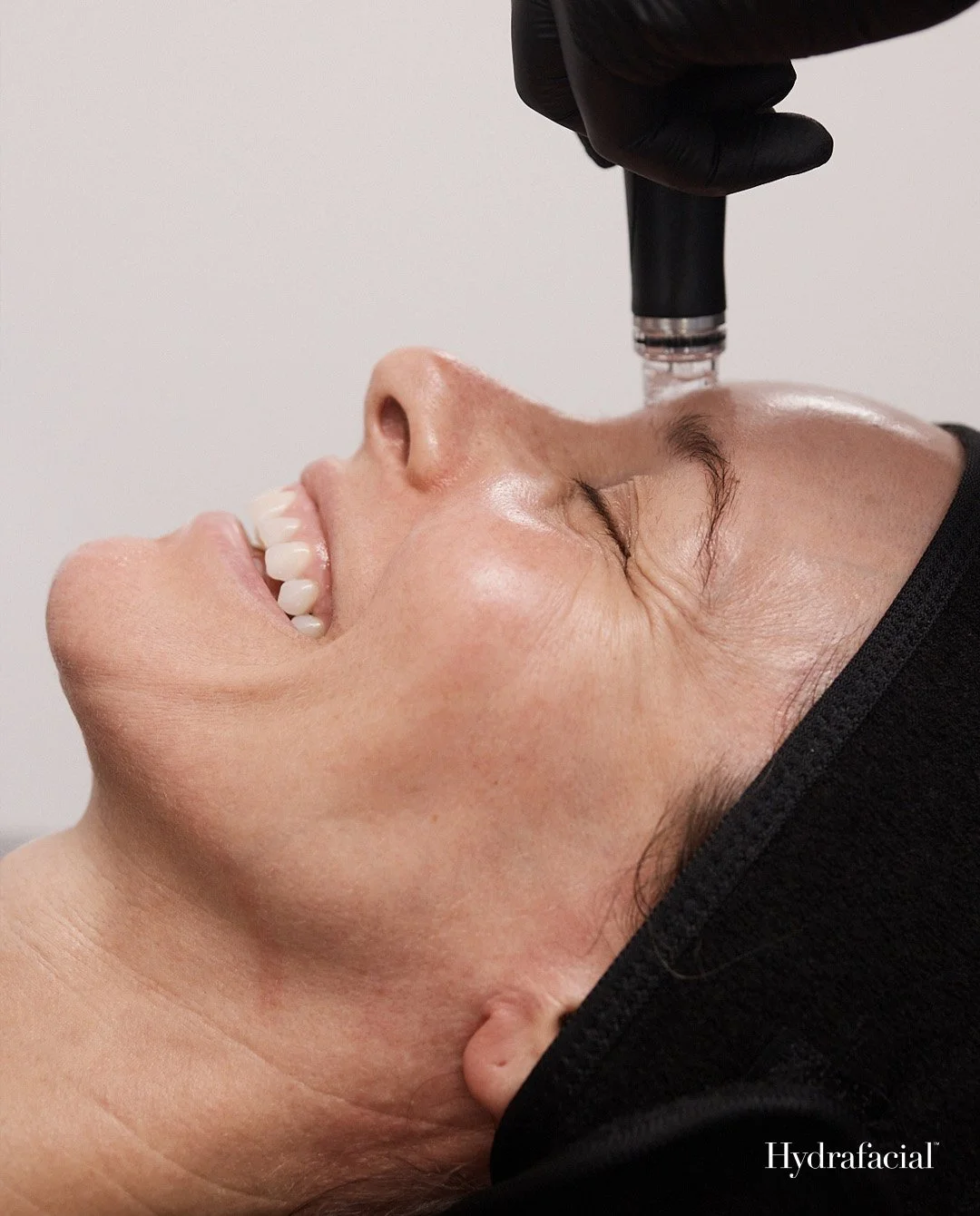 Diamond Hydrafacial - 3 Treatments