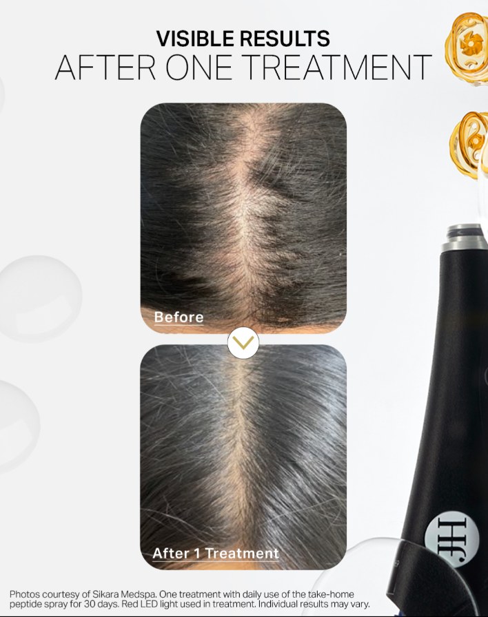 Keravive Hydrascalp Treatment - 3 Treatments