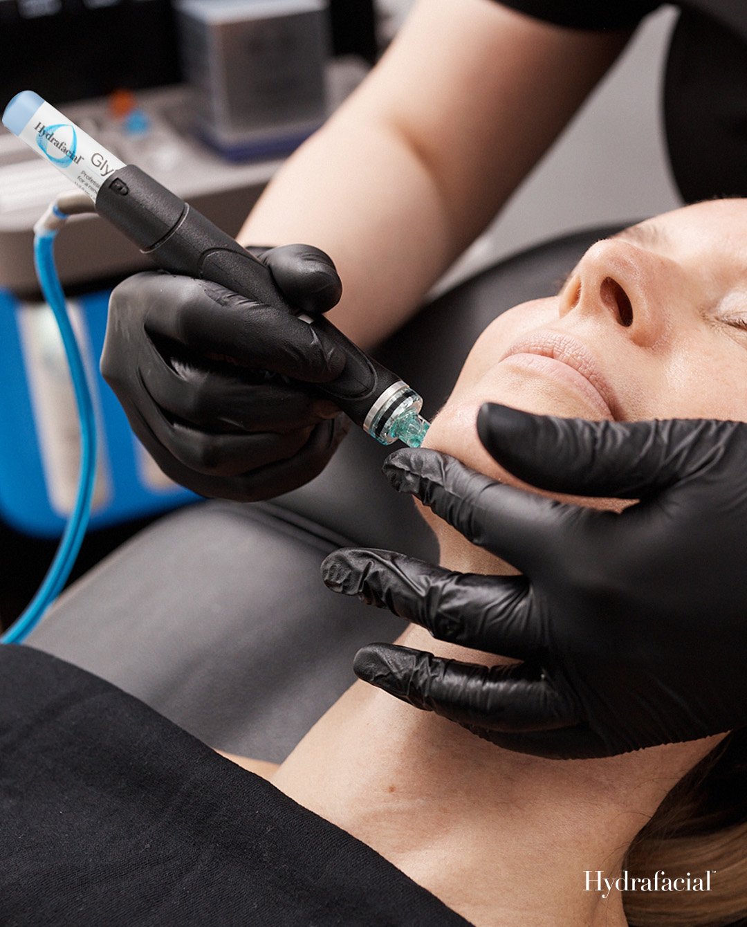 Platinum Hydrafacial. - 3 Treatments