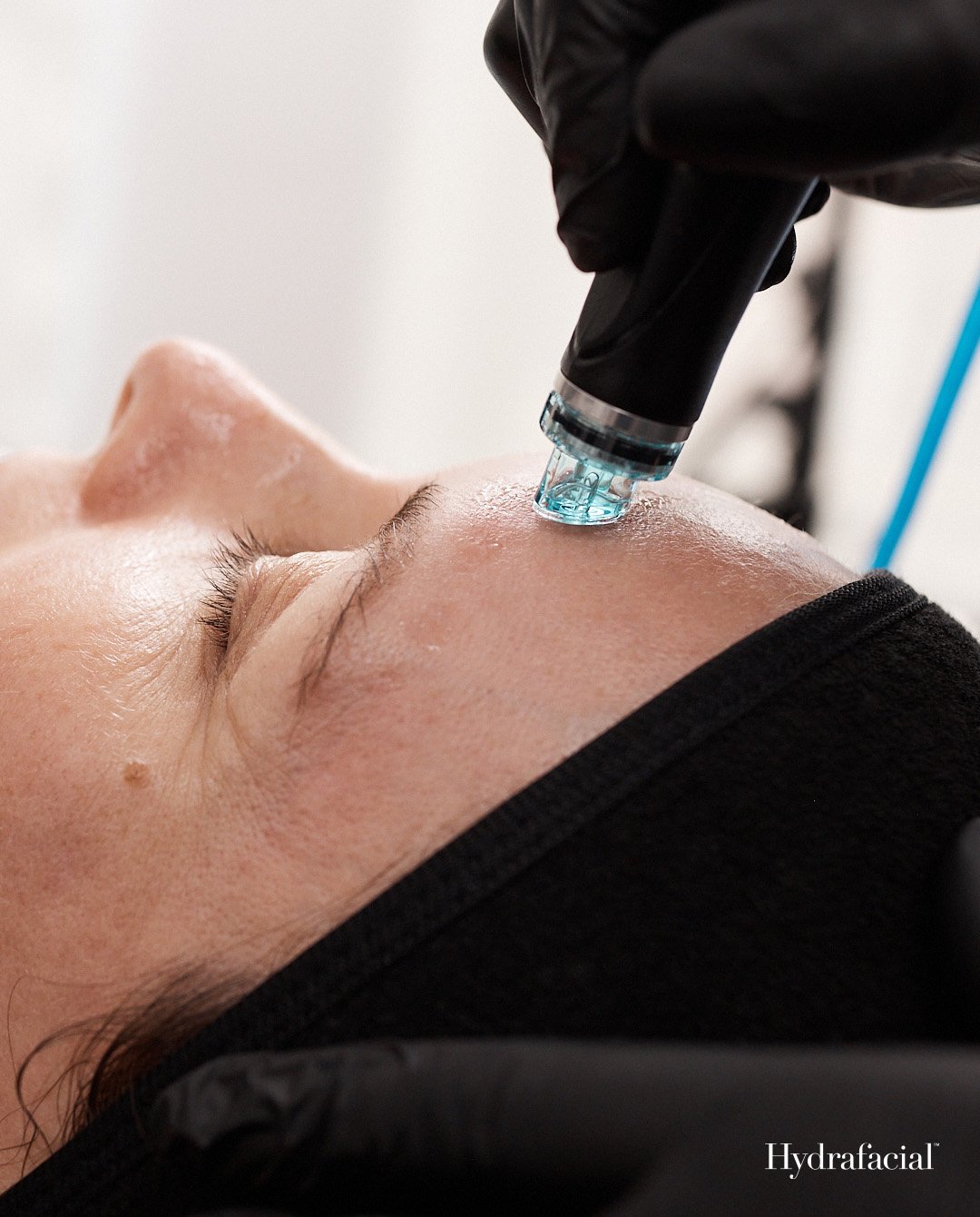 Signature Hydrafacial - 3 Treatments