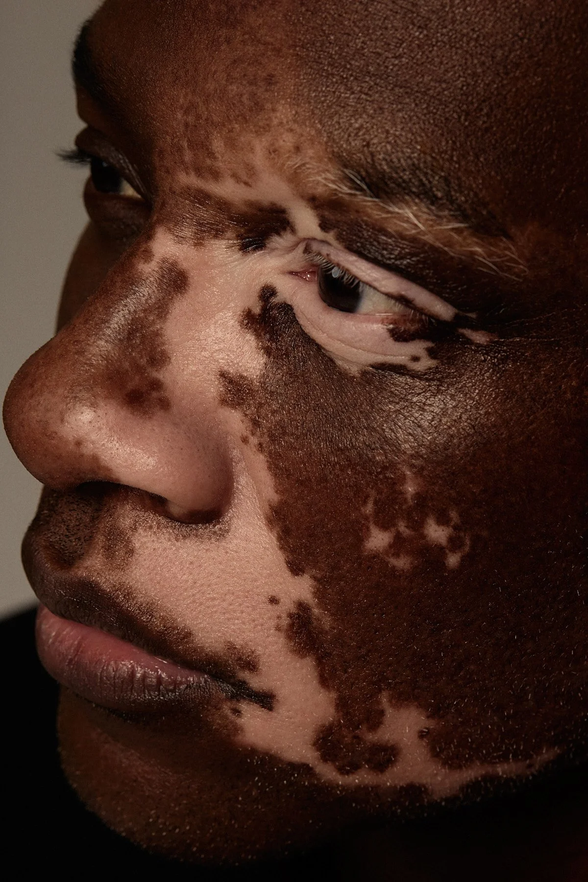 Skin-Deep00151.jpg